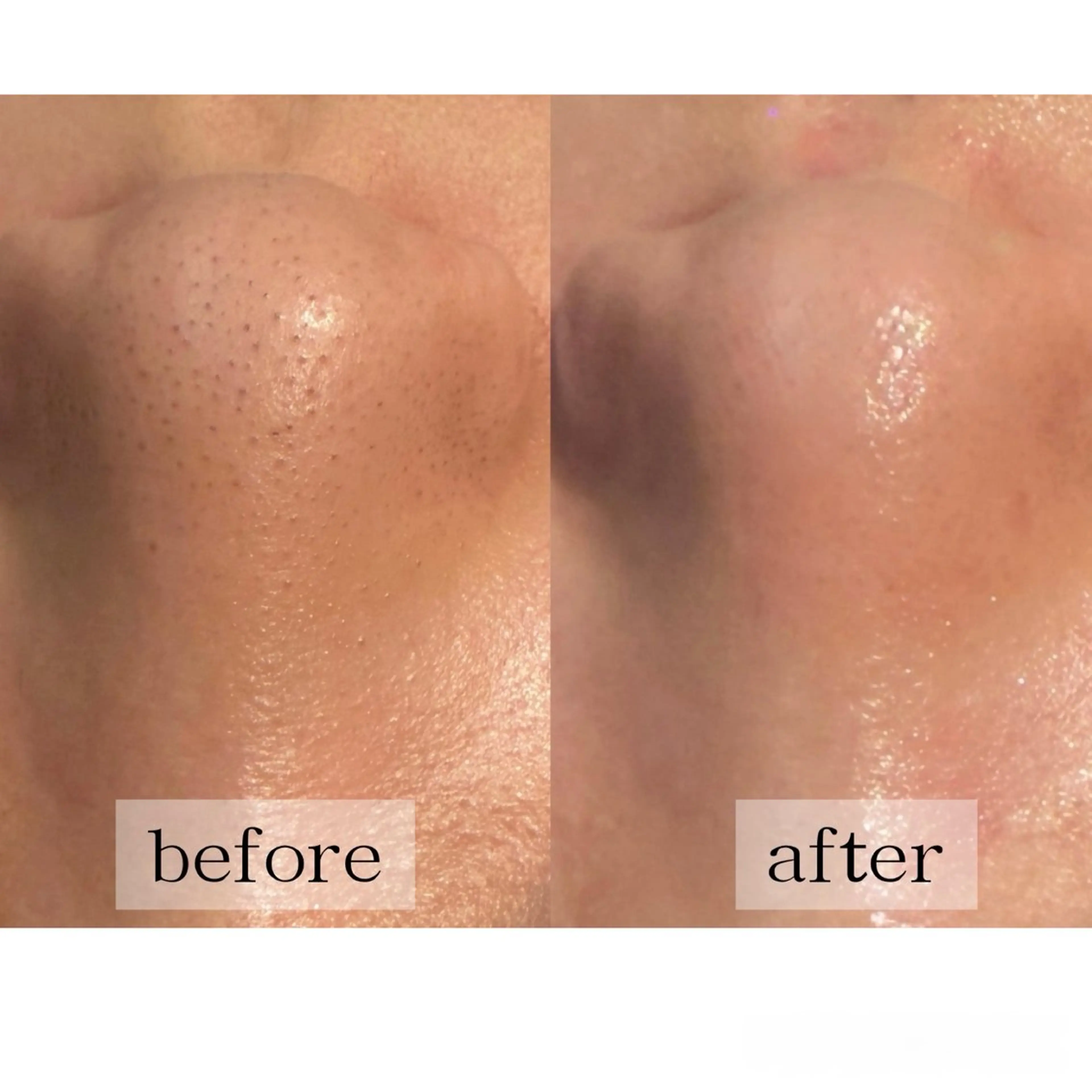 毛穴、肌質ケア専門 グランビューティのエステ・リラクイメージ