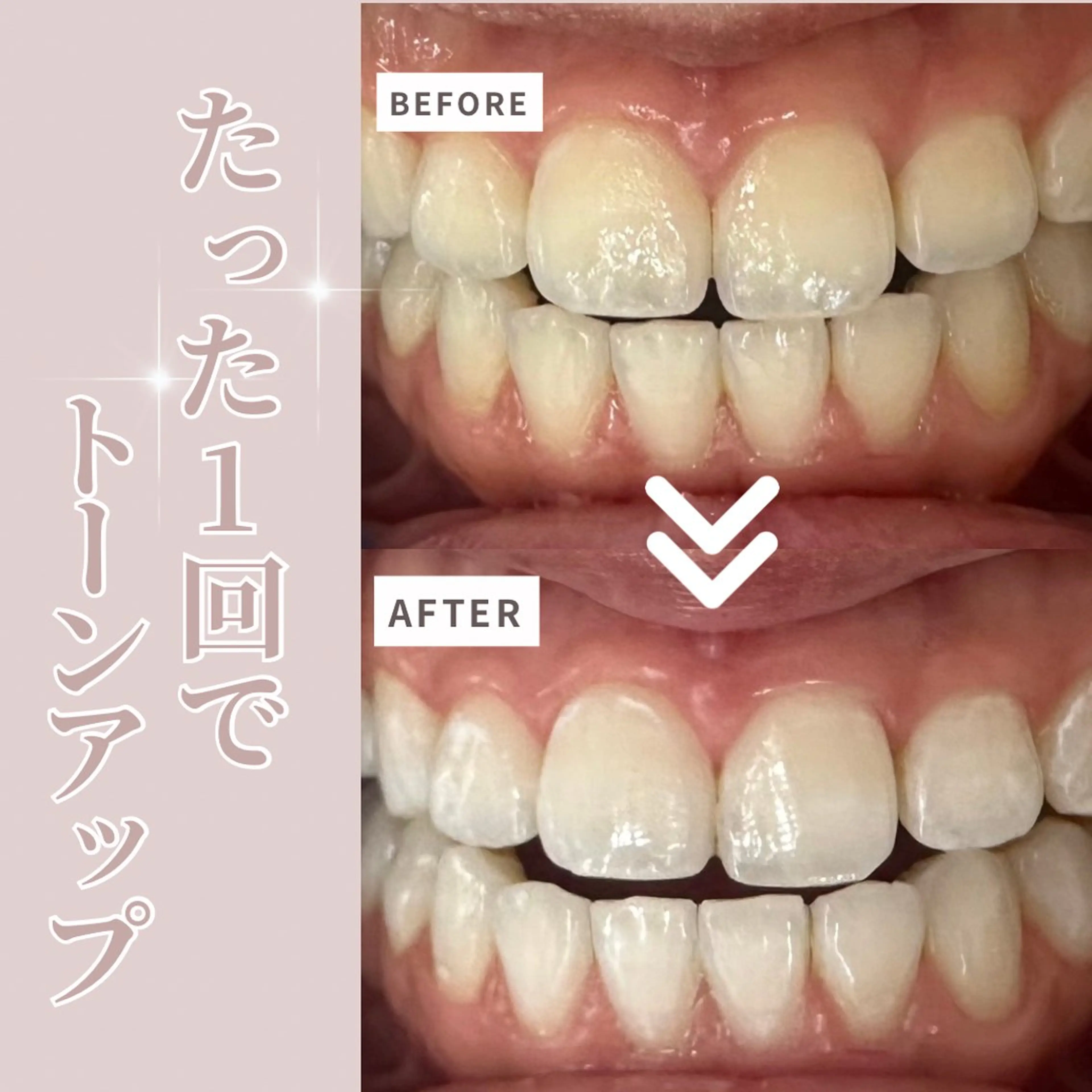 LIBRA自由が丘所属・LIBRA自由が丘 ホワイトニングのその他イメージ