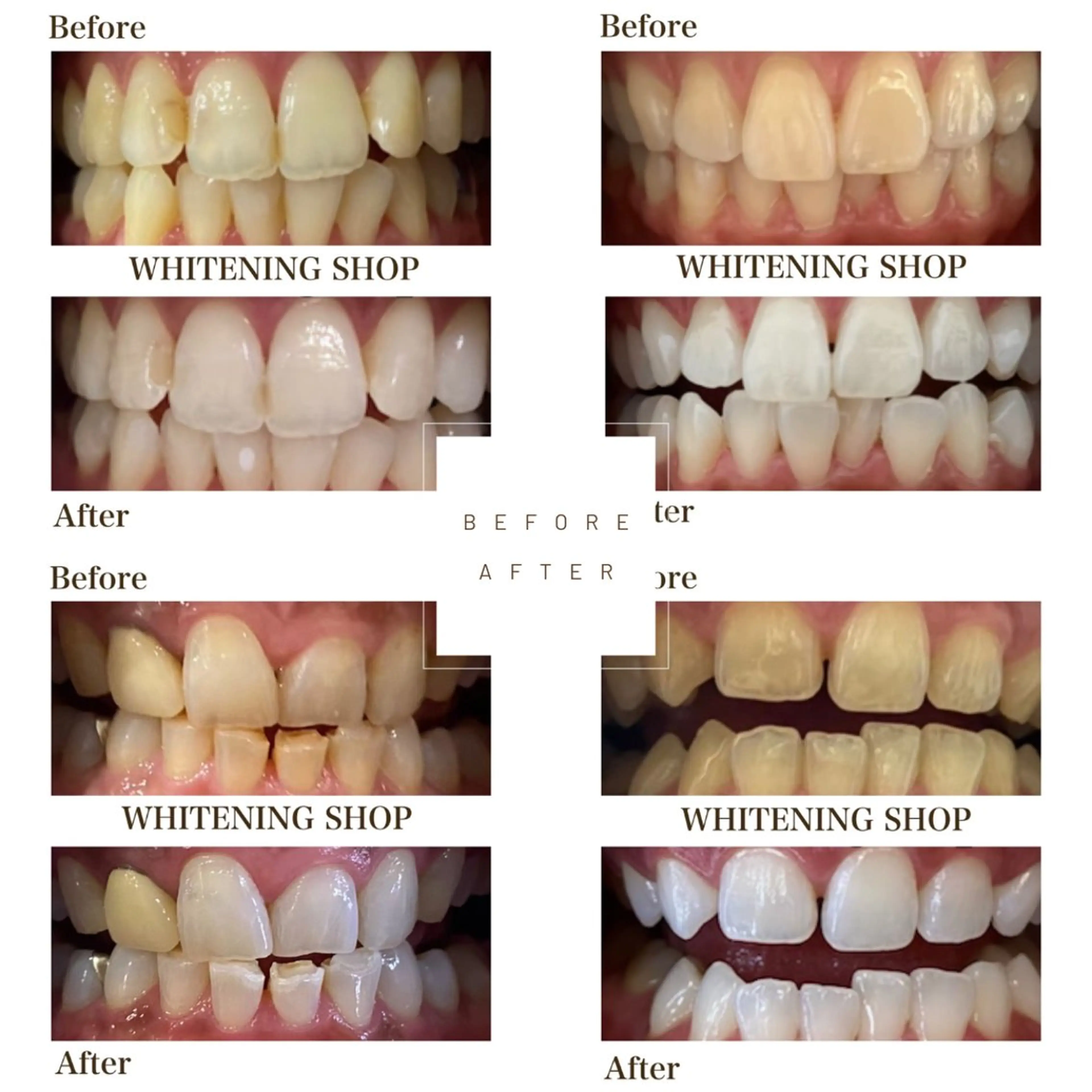 ホワイトニングショップ伊丹店所属・ホワイトニング ショップ伊丹店のその他イメージ