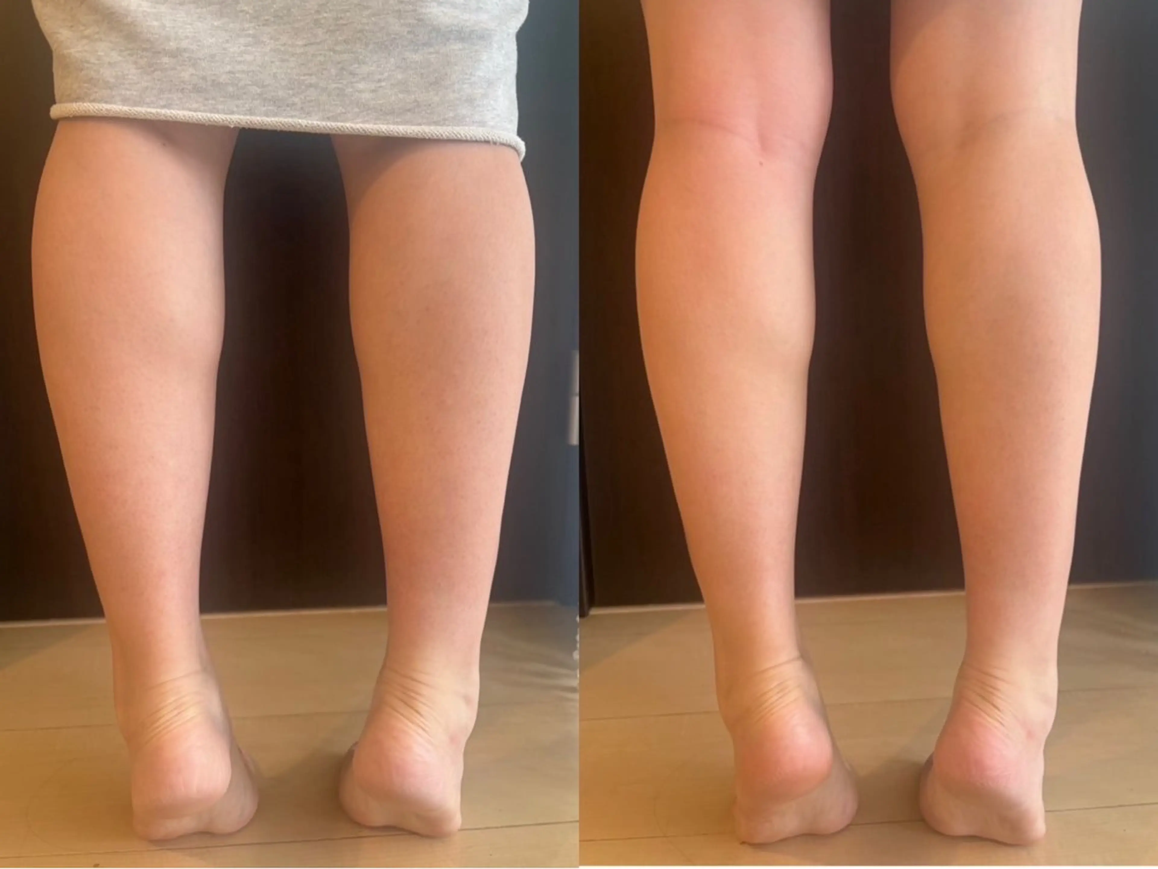 【初回限定】全身即効デトックス 45分 ✨足の浮腫み、肩こり日頃の疲労スッキリ🍃の写真