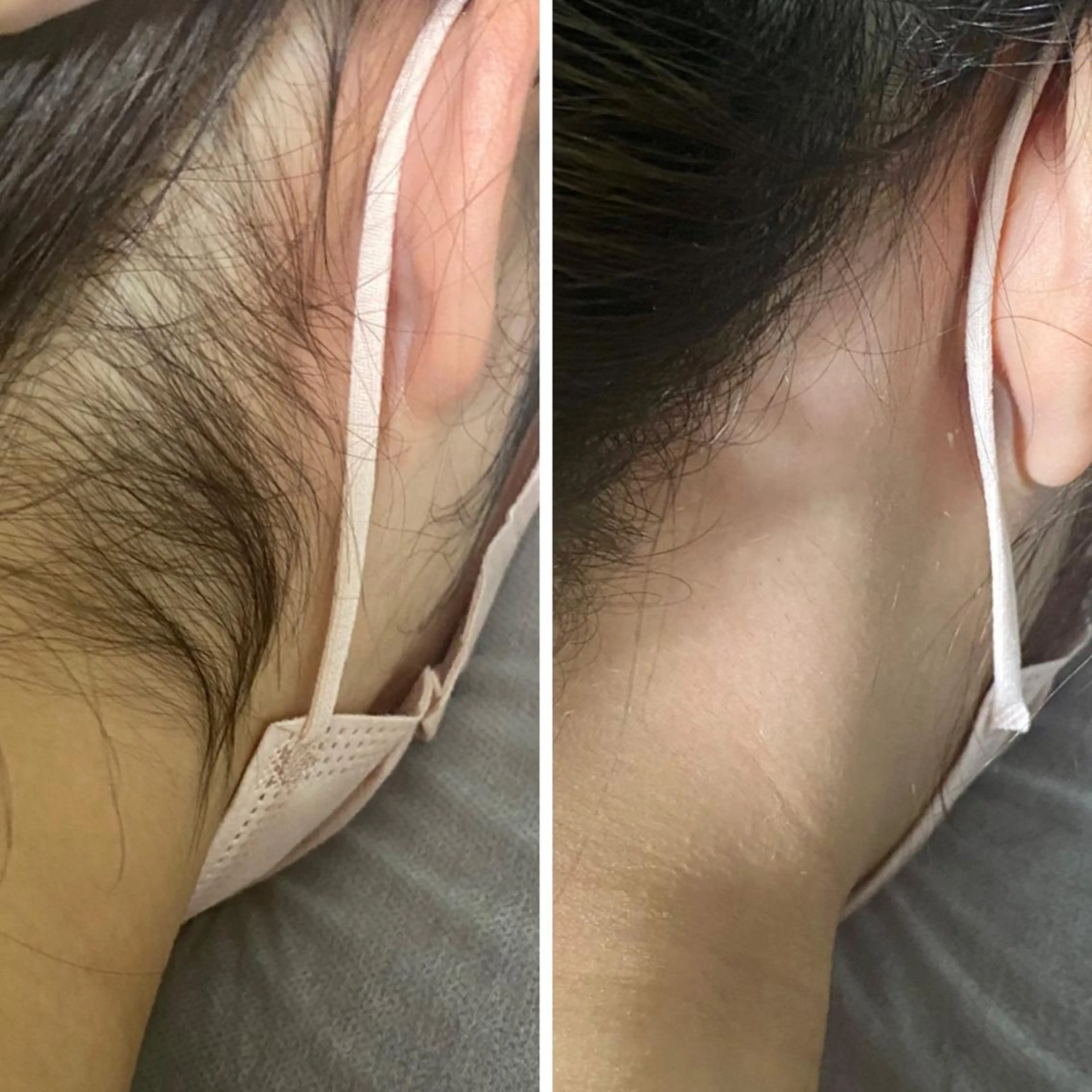 脱毛 脱毛サロンLULA 恵比寿店　笠松のエステ・リラクイメージ