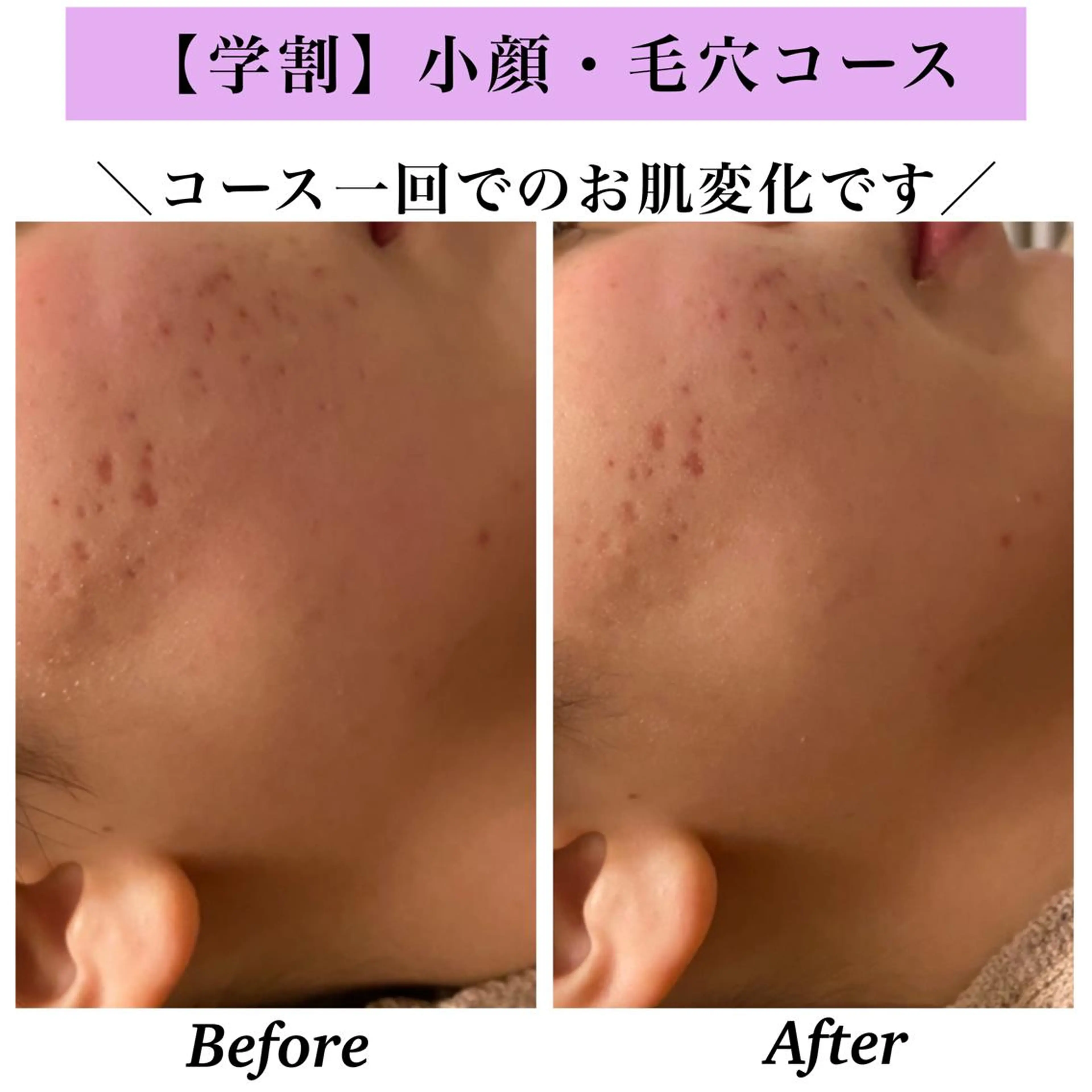 Bellesthe （ベルエステ）のエステ・リラクイメージ