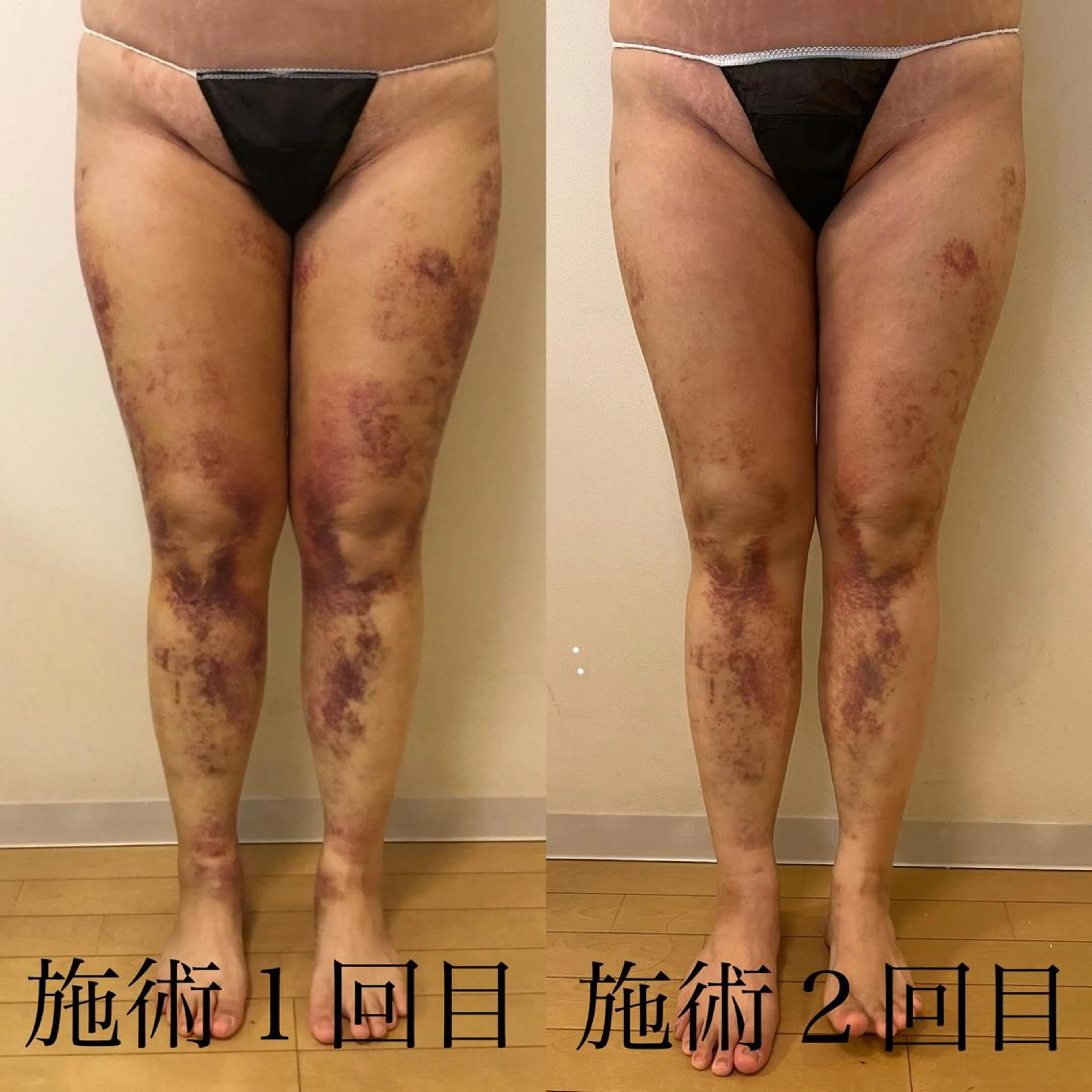 WOM SALON所属・MIKU【美容整形ダ ウンタイムケア銀座】のエステ・リラクイメージ