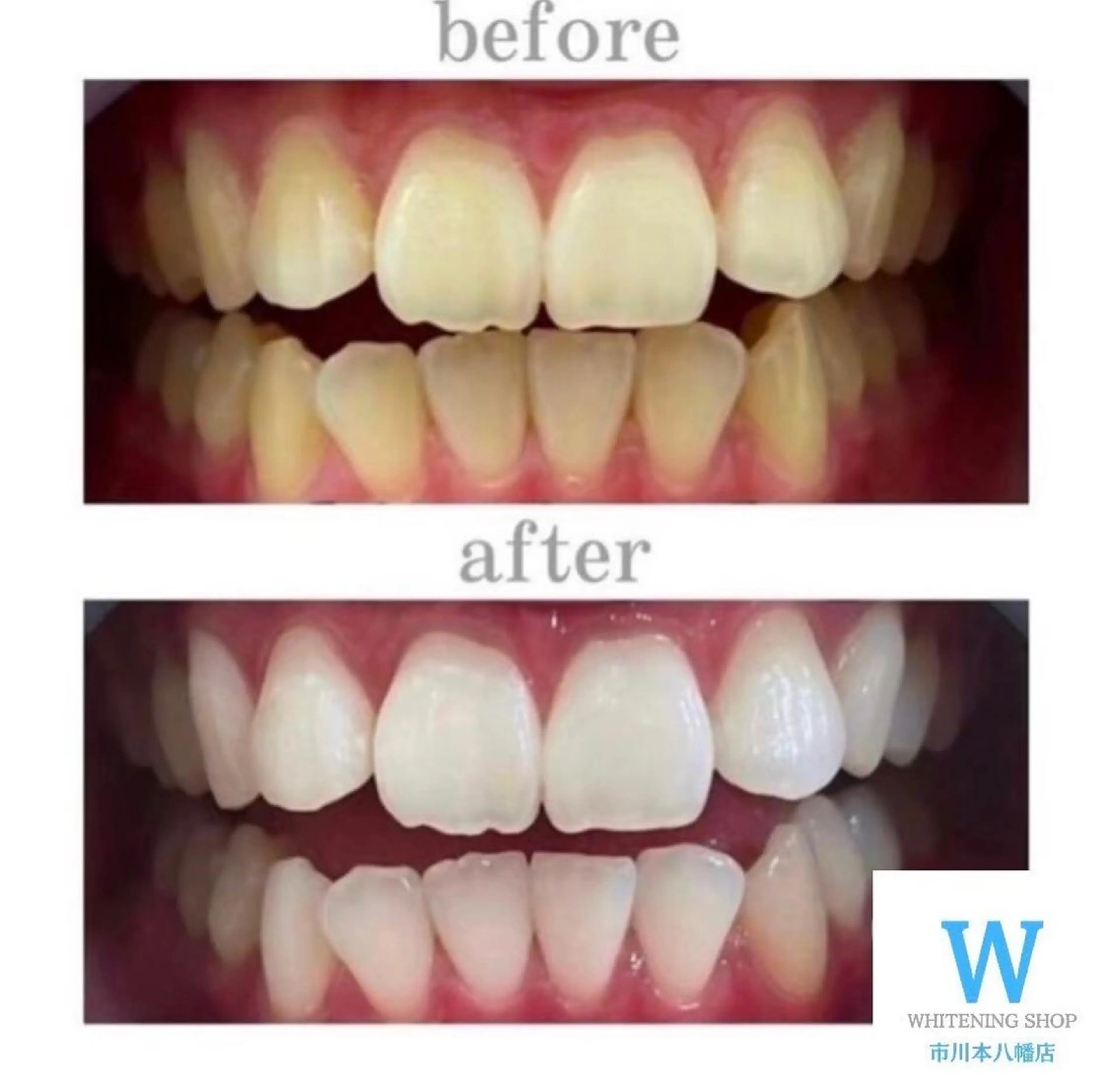 ホワイトニング ショップ本八幡店のエステ・リラクイメージ