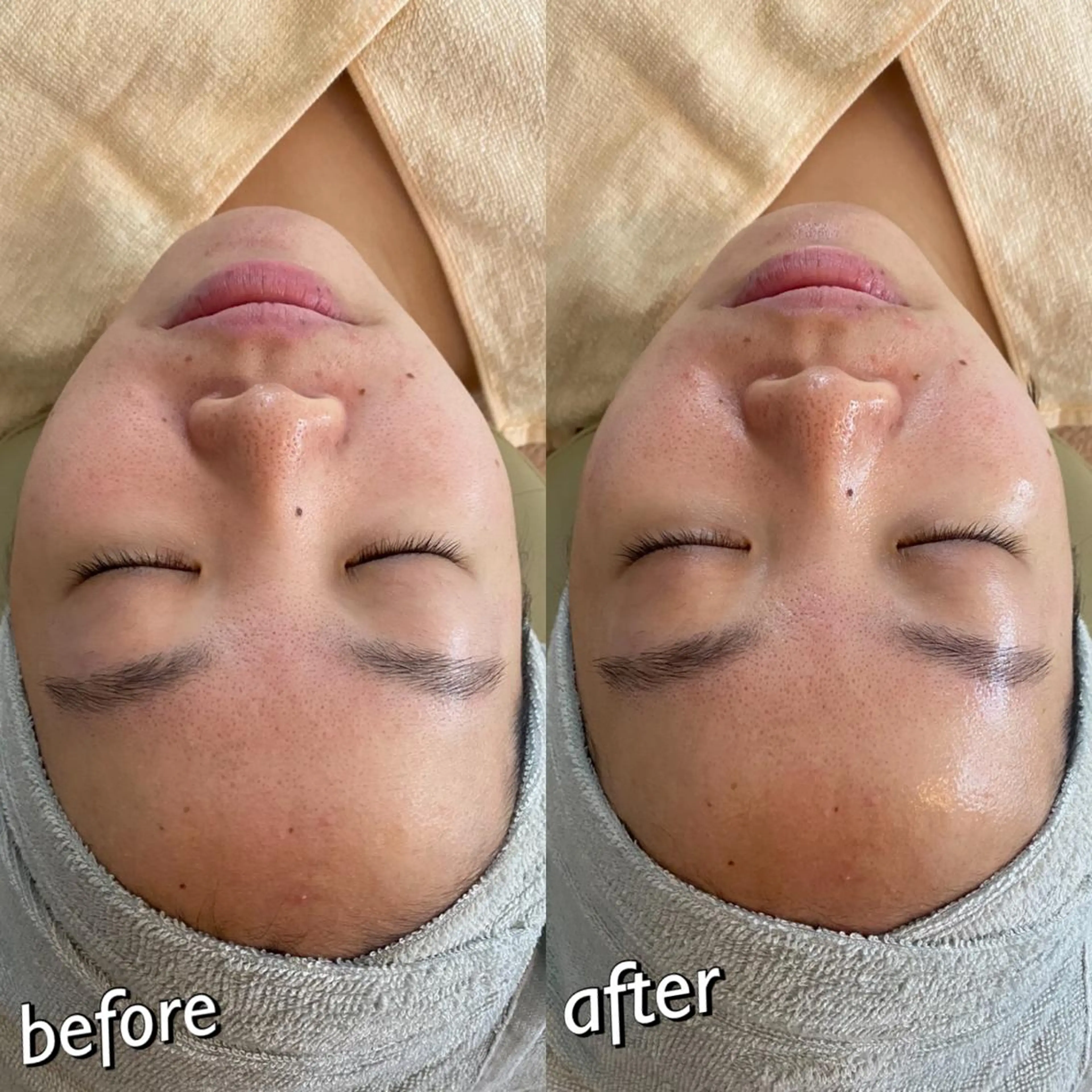 うなじ脱毛/美肌脱毛 LABELのエステ・リラクイメージ