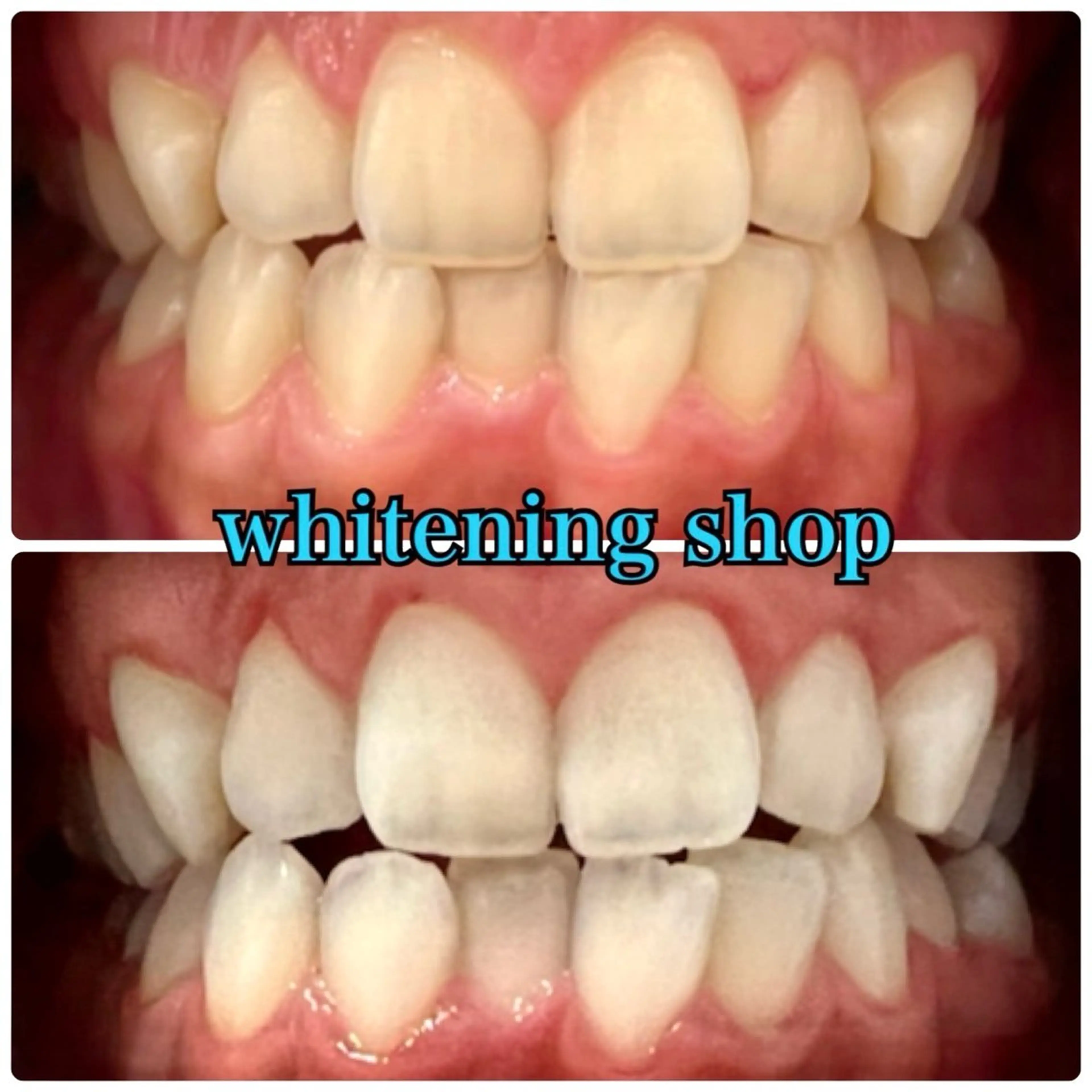 メンズ エステ リラク ホワイトニング ショップ川越店のエステ・リラクイメージ