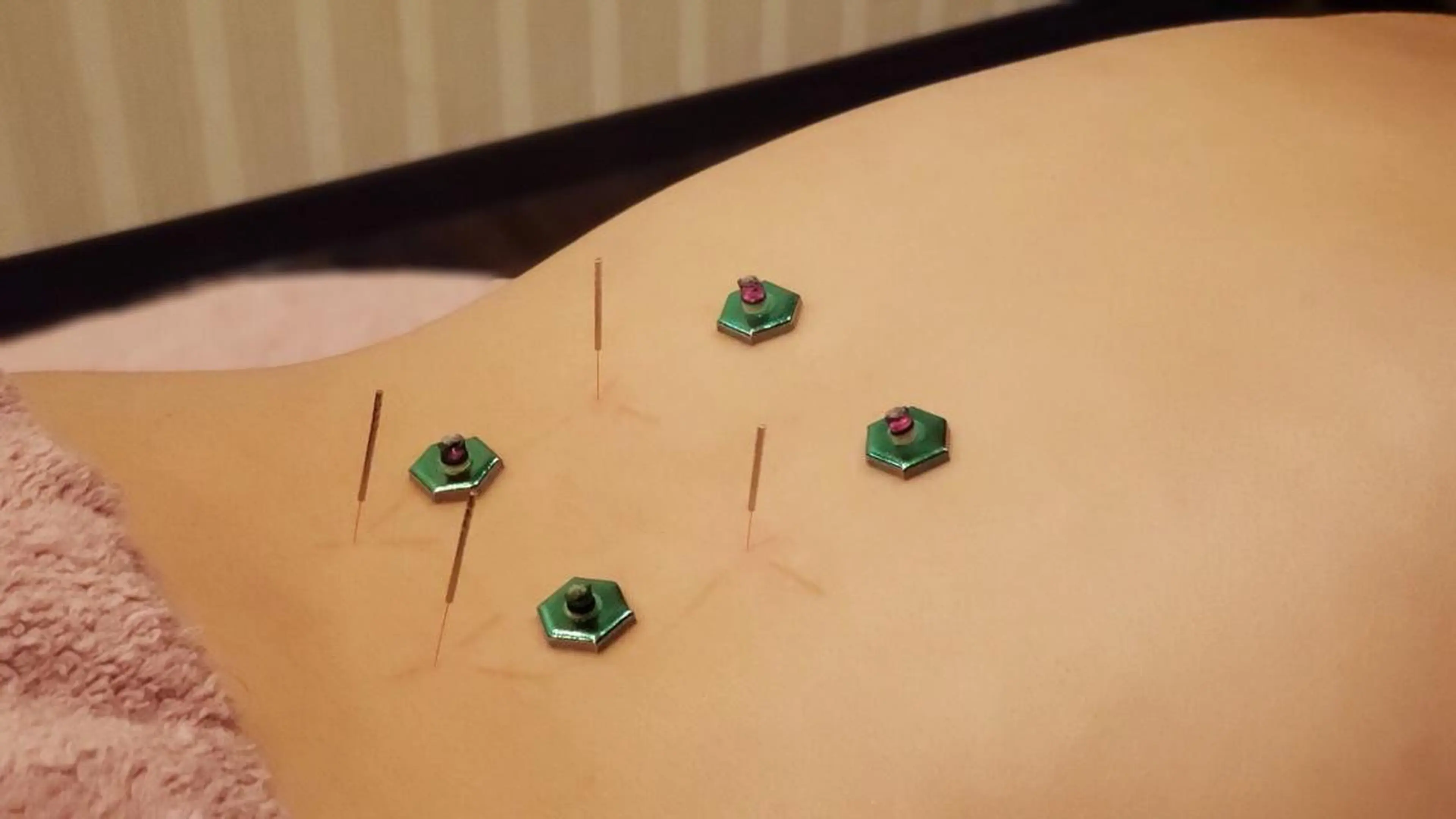 表参道 ポルクス整骨院のエステ・リラクイメージ