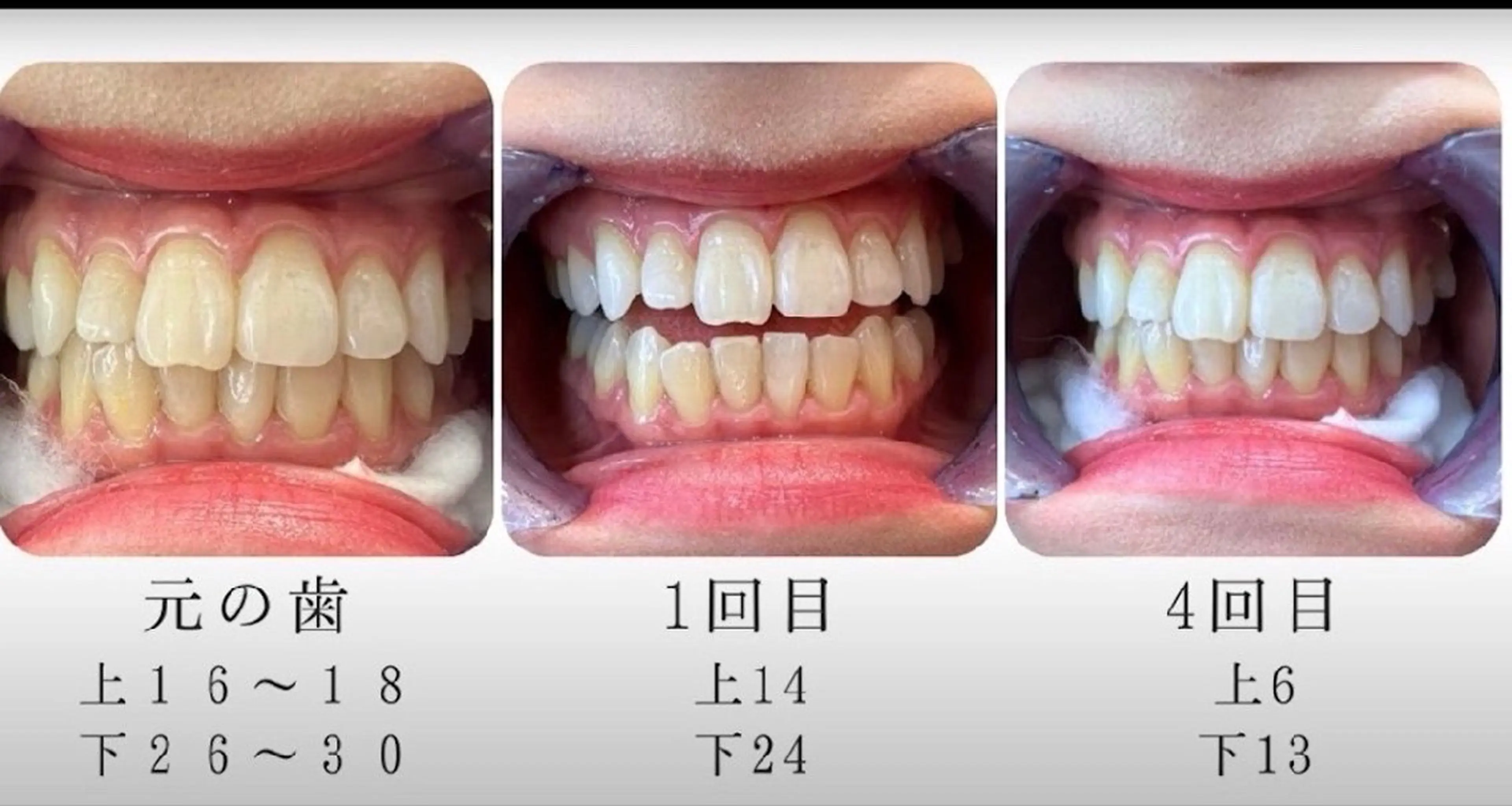 エステ エクシアホワイト 立川南口のエステ・リラクイメージ