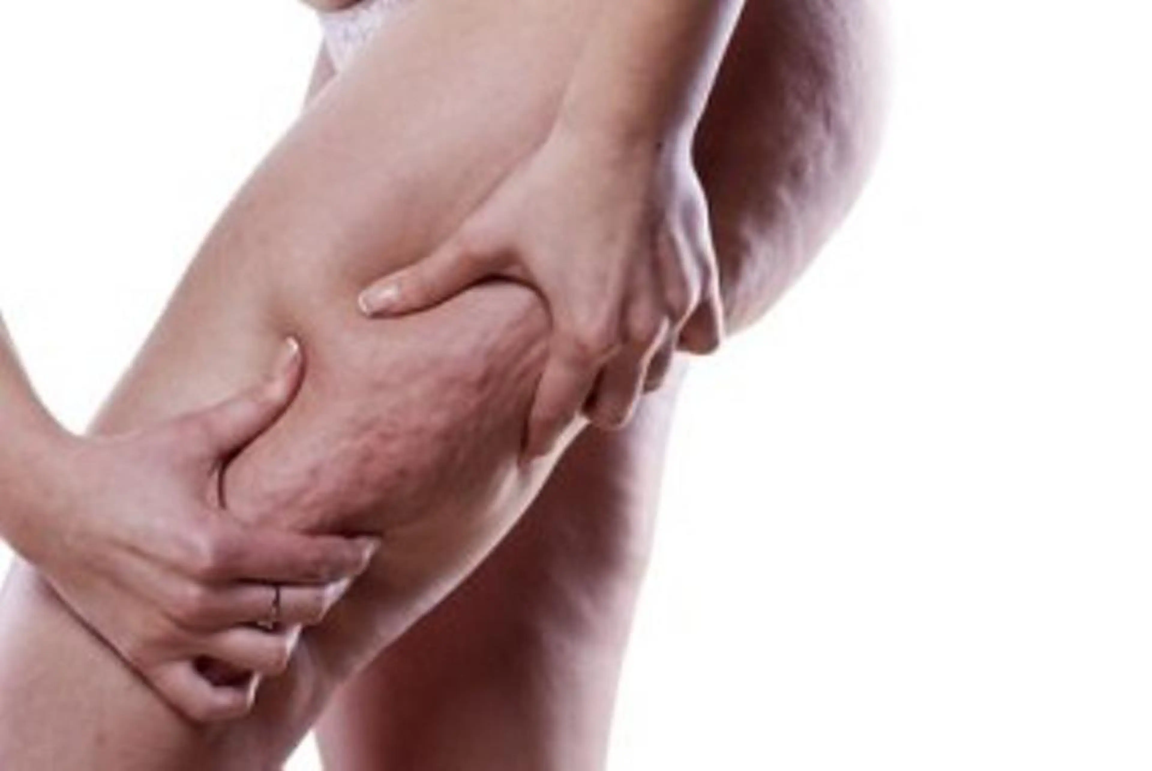 ボディエステ （初回のみ カウンセリング＋施術 60分程度）下肢全般の写真