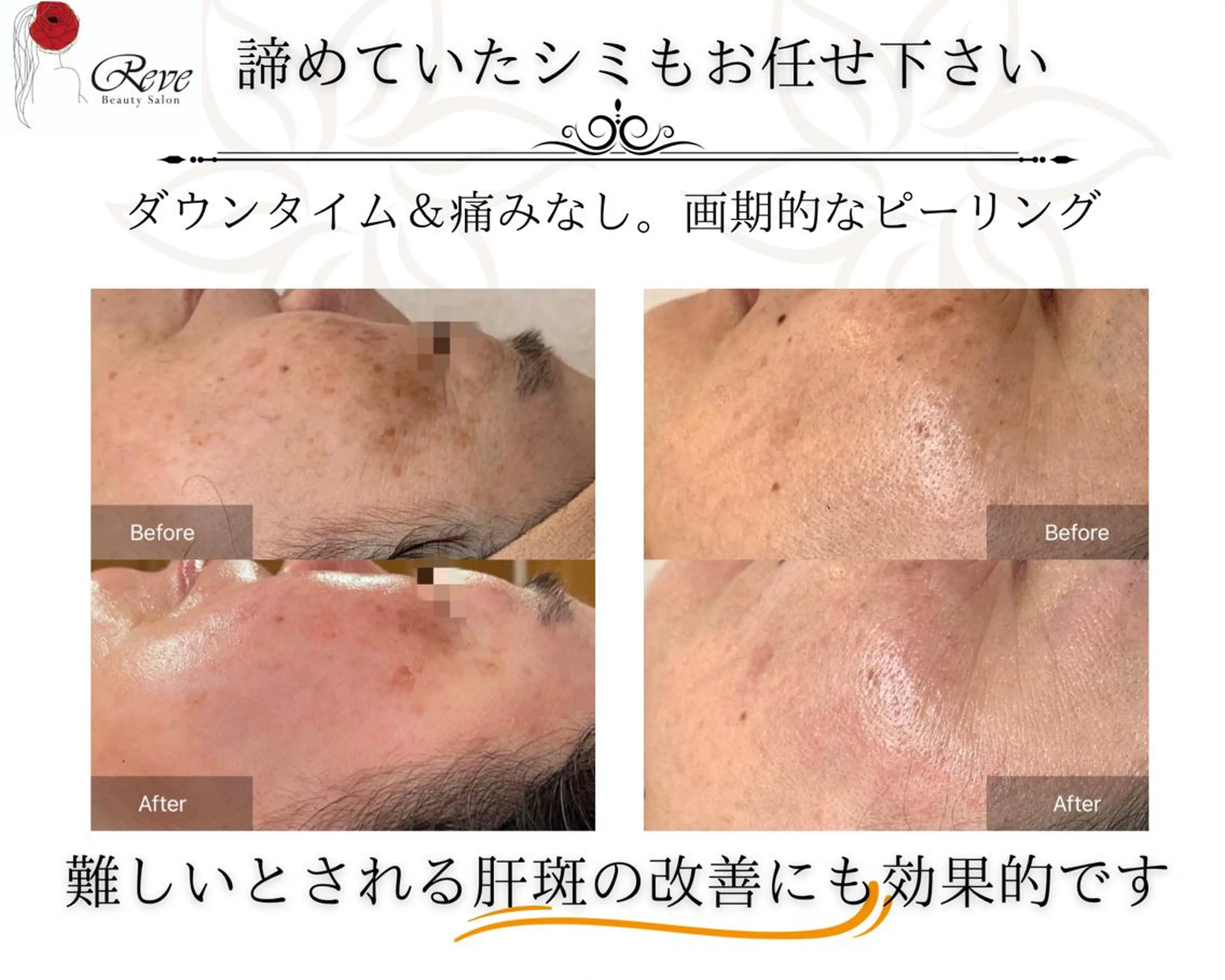 エステ 堀井 舞琳のエステ・リラクイメージ