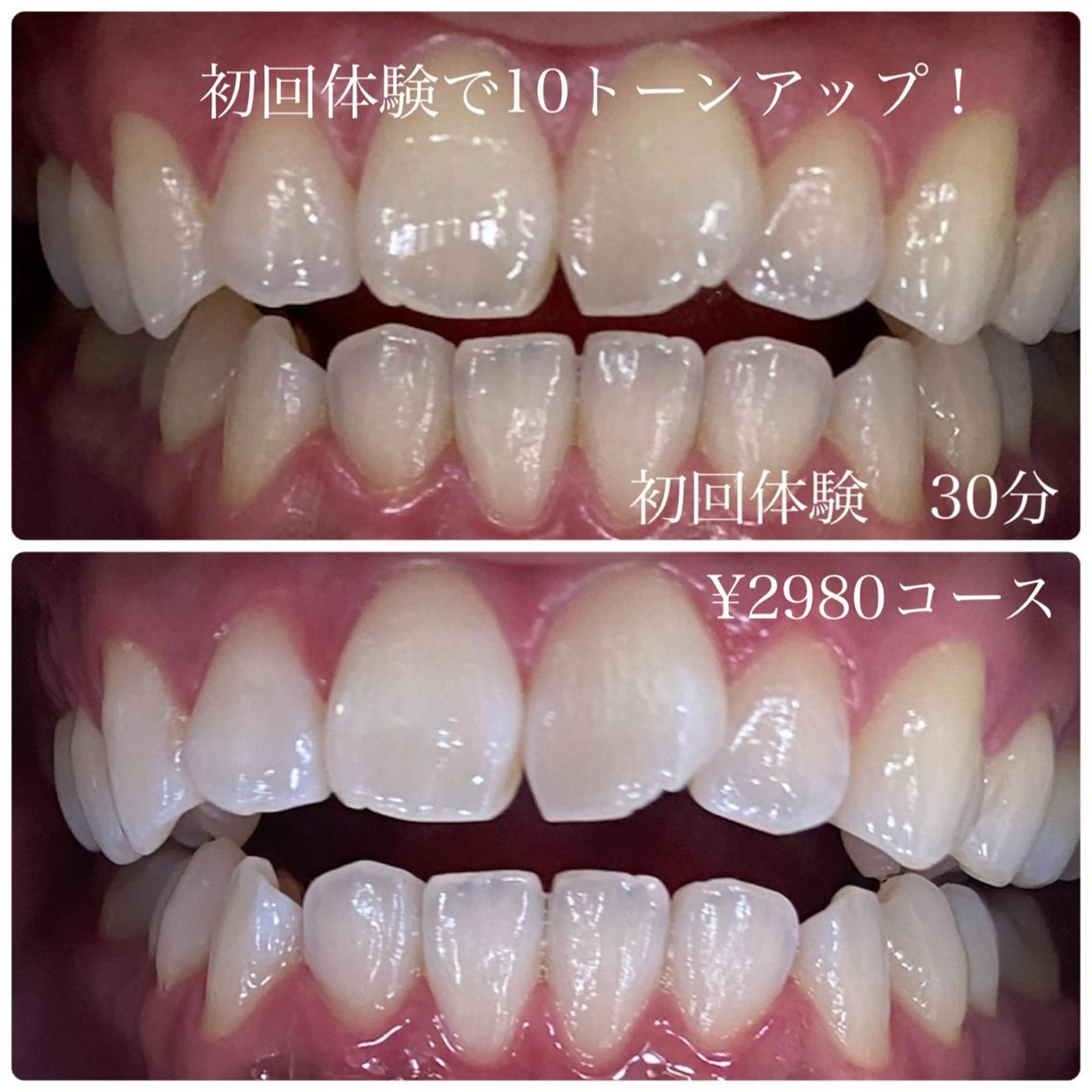 その他 ホワイトニングルーム　川崎店所属・ホワイトニング ルーム　川崎店のその他イメージ