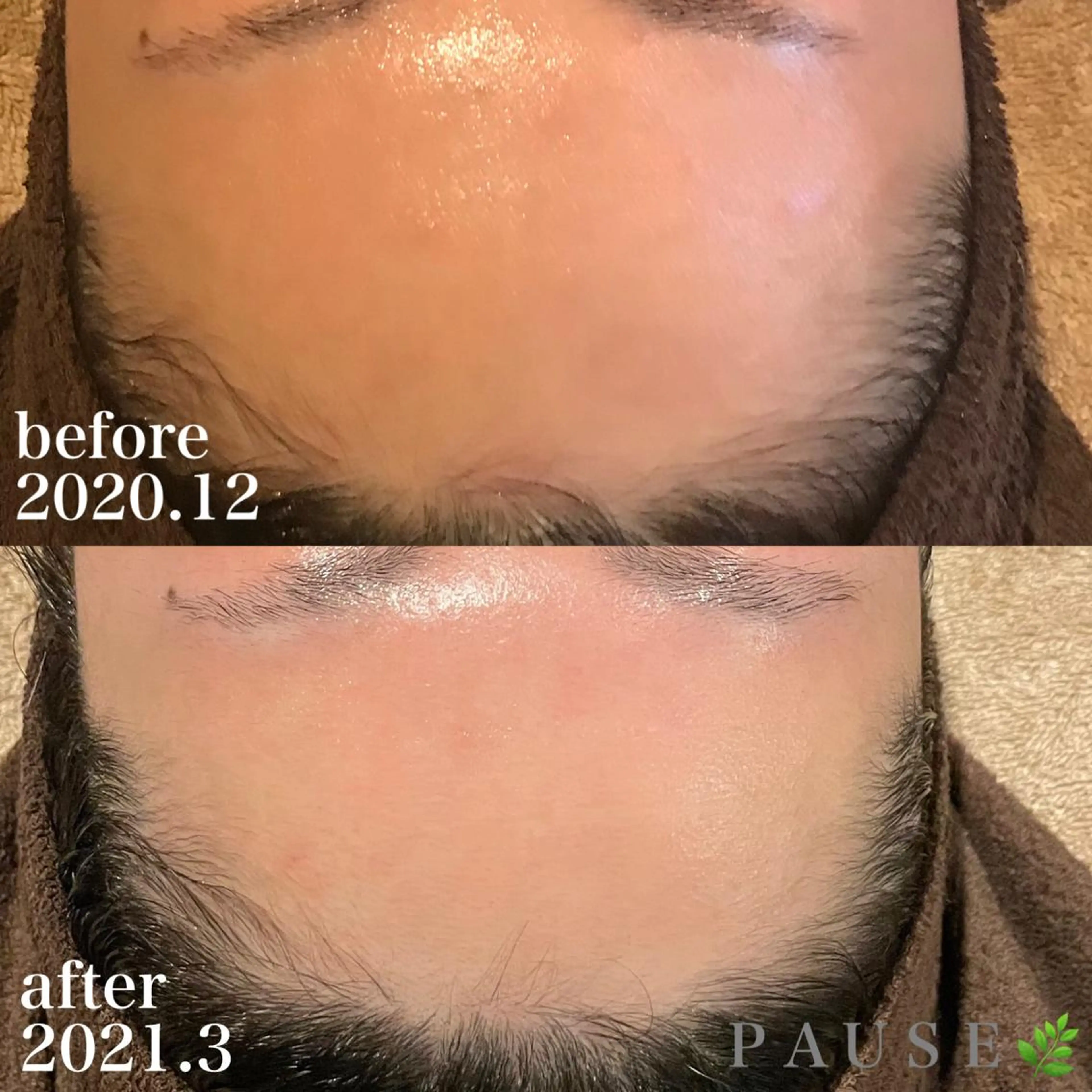 エステ 浜野 恵美のエステ・リラクイメージ