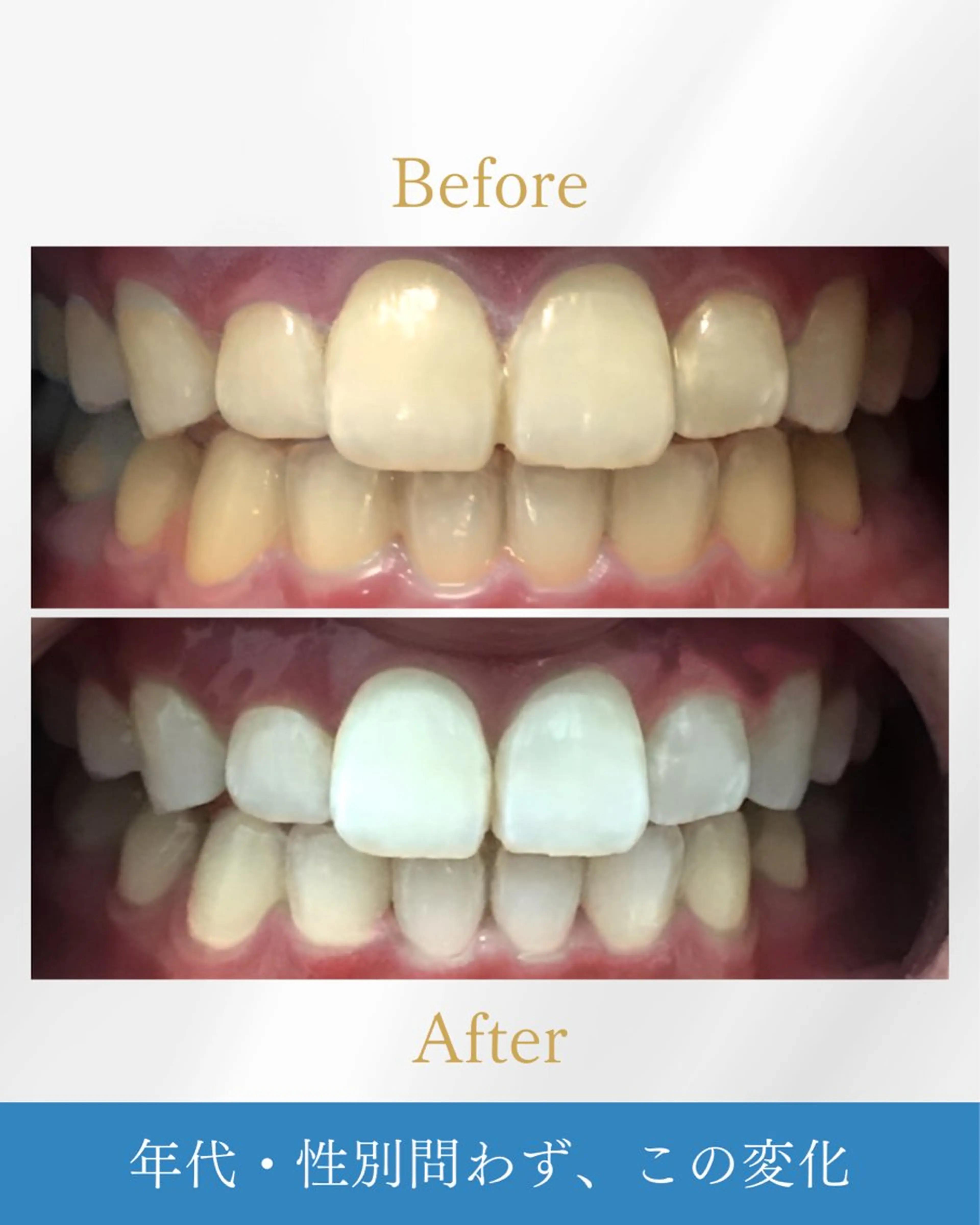 NAホワイトニング溝の口店所属・NAホワイトニング 溝の口店のエステ・リラクイメージ