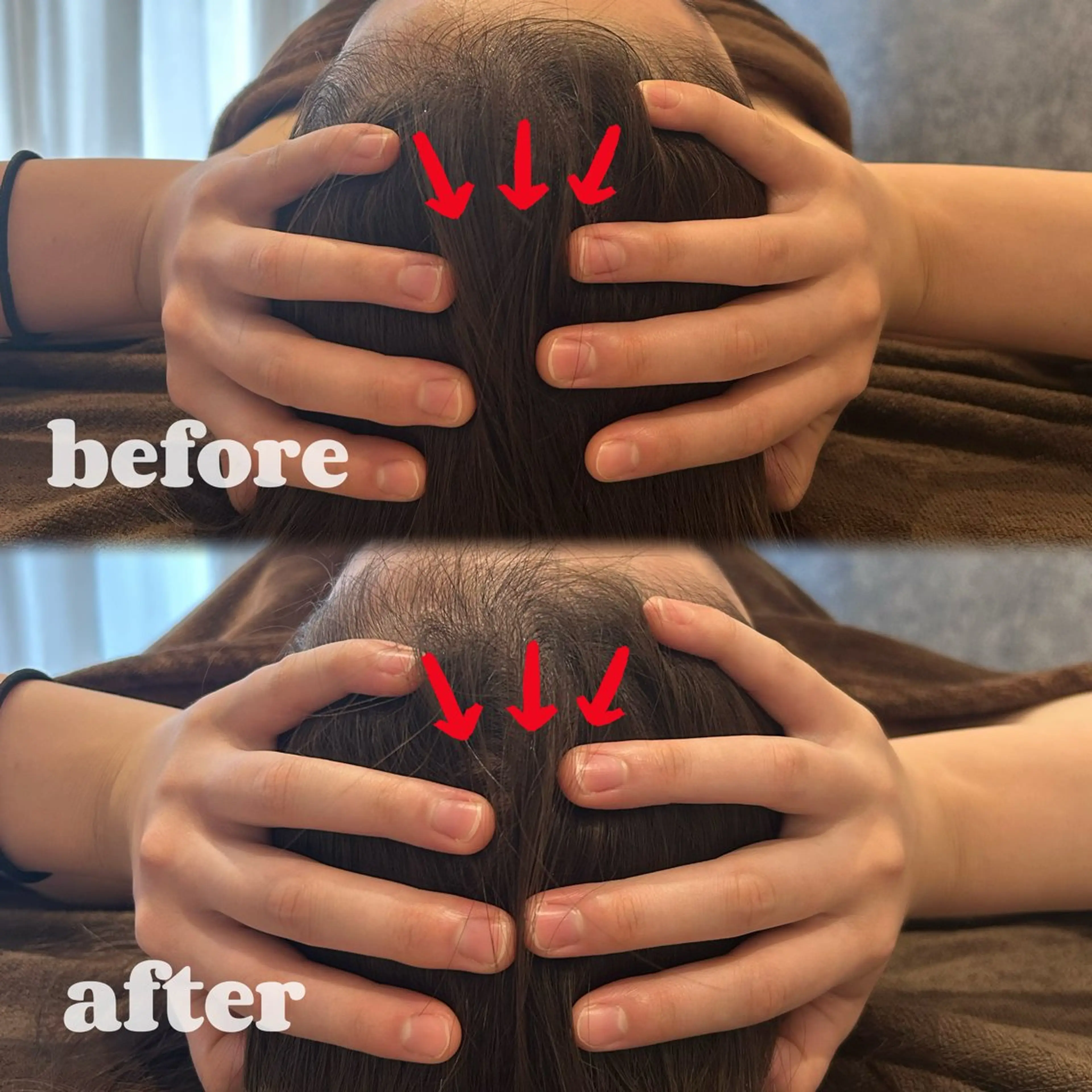 頭蓋骨矯正付きコース💆🏻‍♀️頭も小さくなりたい方限定クーポンの写真