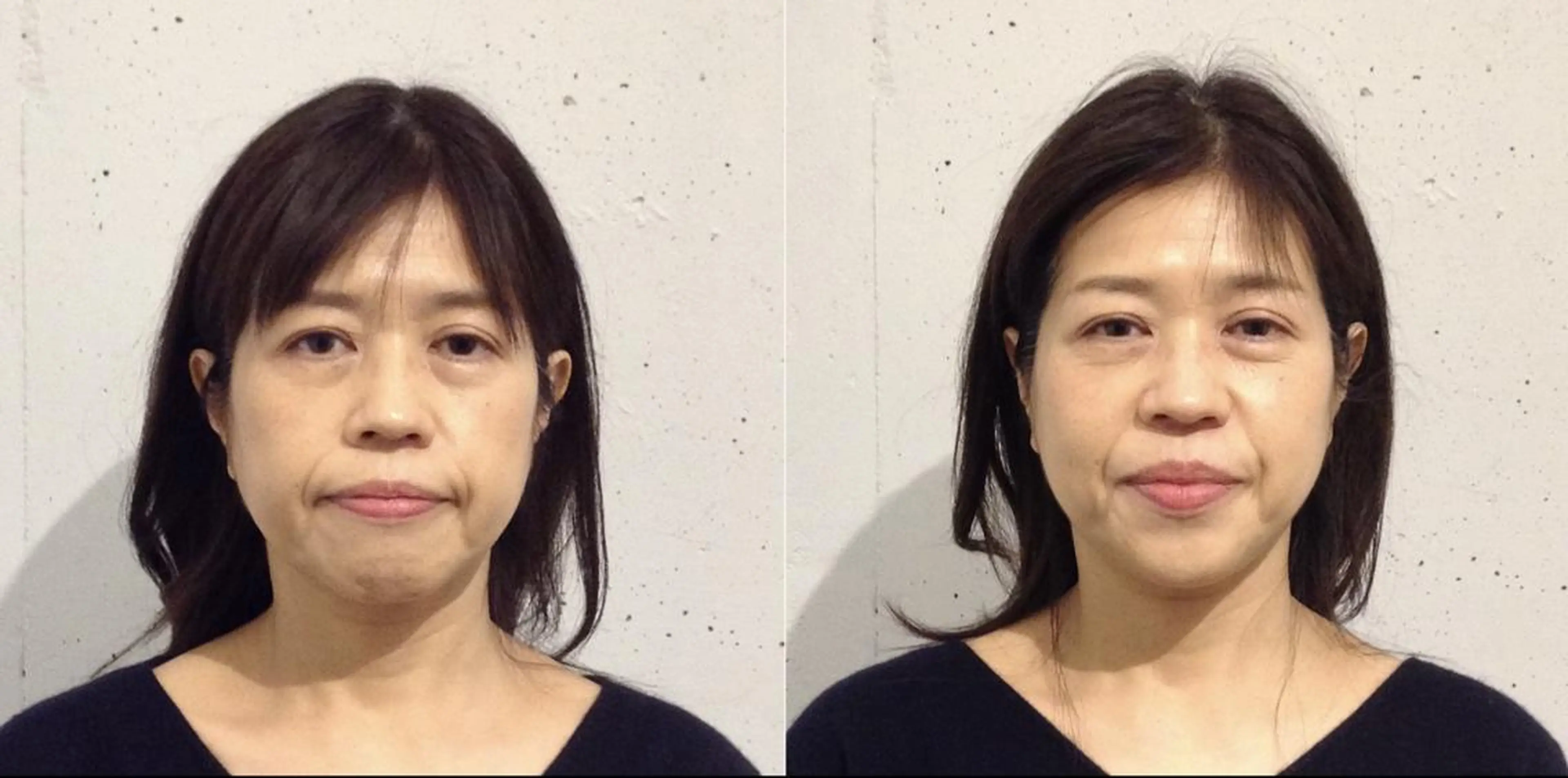 美容整体　小顔矯正 プラスフィール 松本のエステ・リラクイメージ