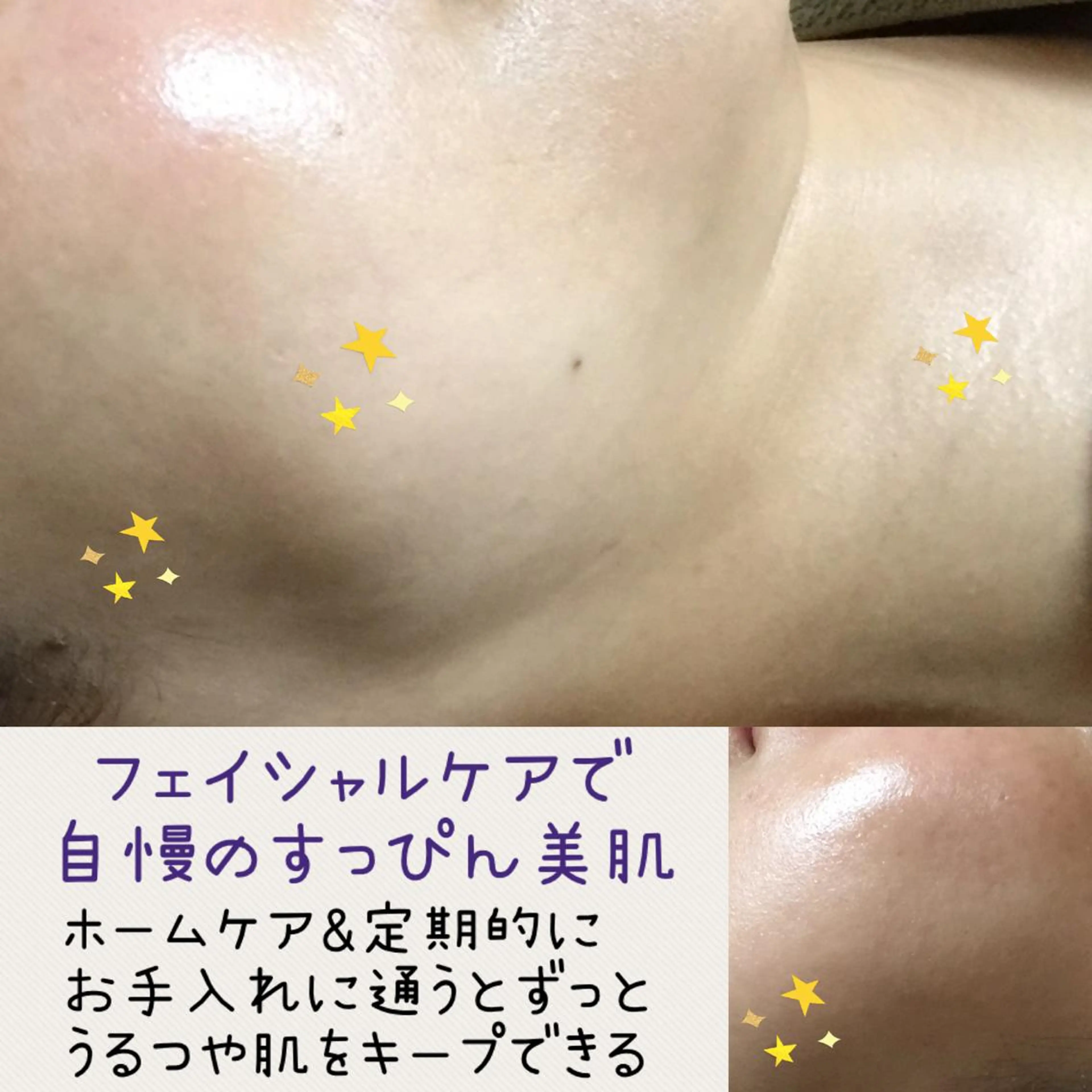 光 フェイシャル / エイジング 素肌の活性化 90分 デコルテ首肩も触ります!の写真