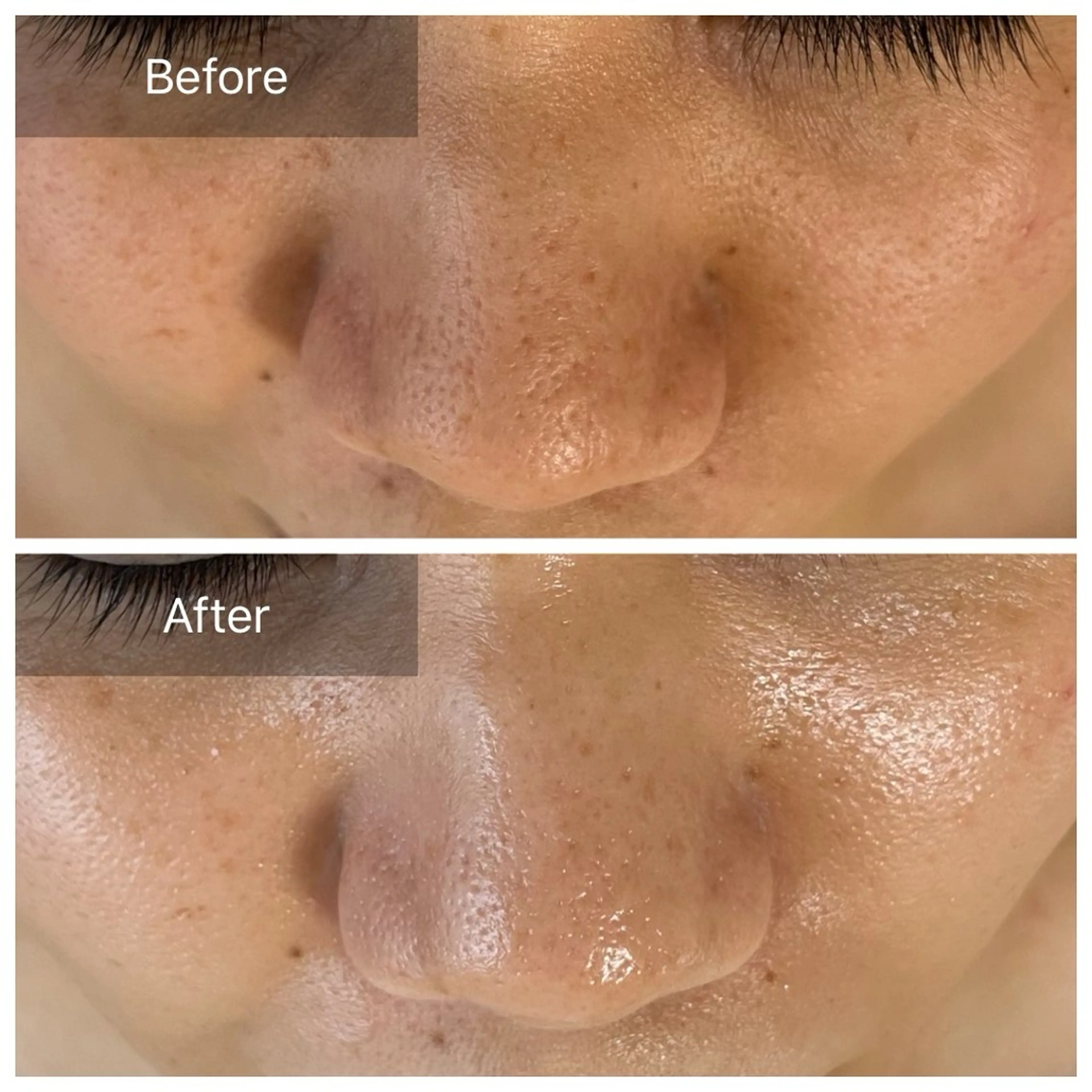 毛穴が見えなくなるサロン  Horo所属・岡 えり子のエステ・リラクイメージ