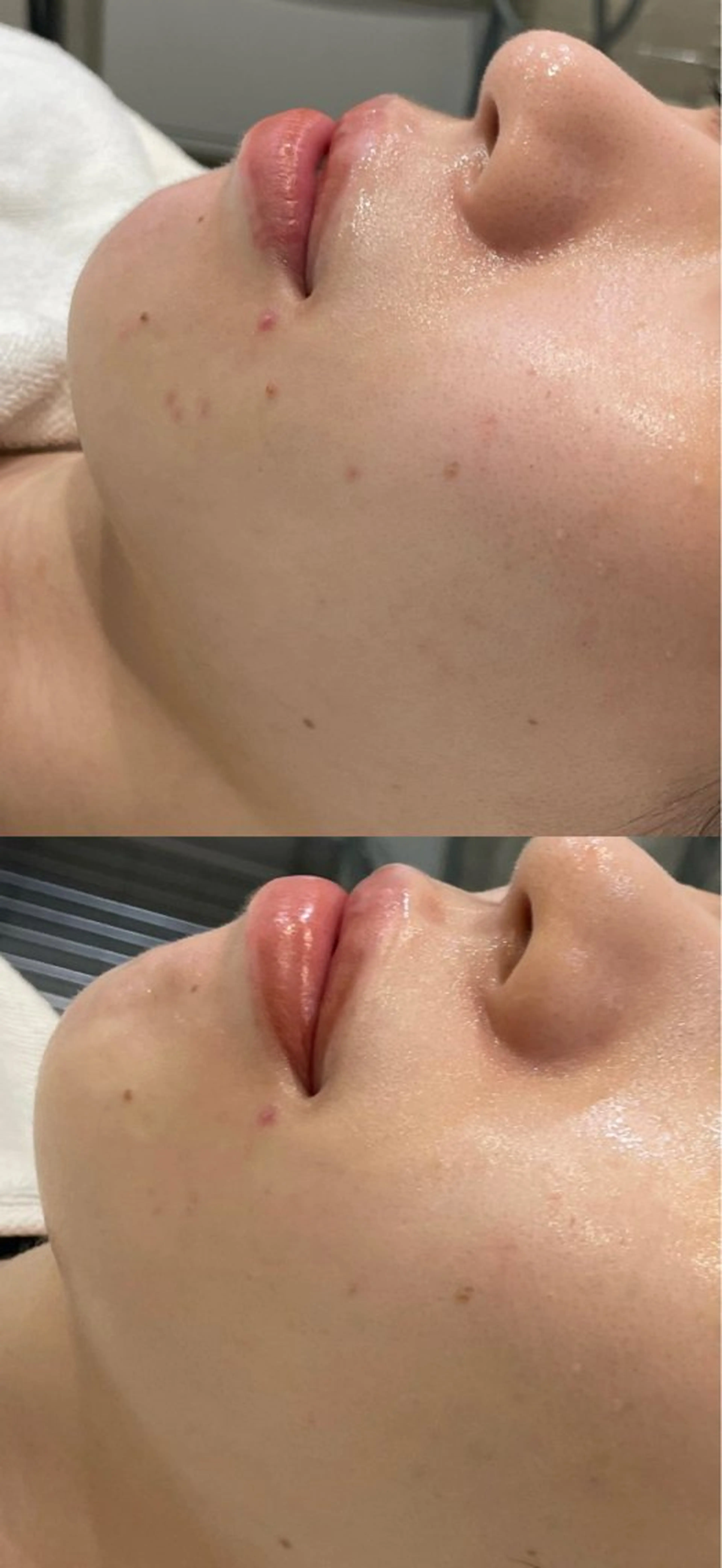 エステ DeI'm   名古屋栄所属・小林 玲菜のエステ・リラクイメージ