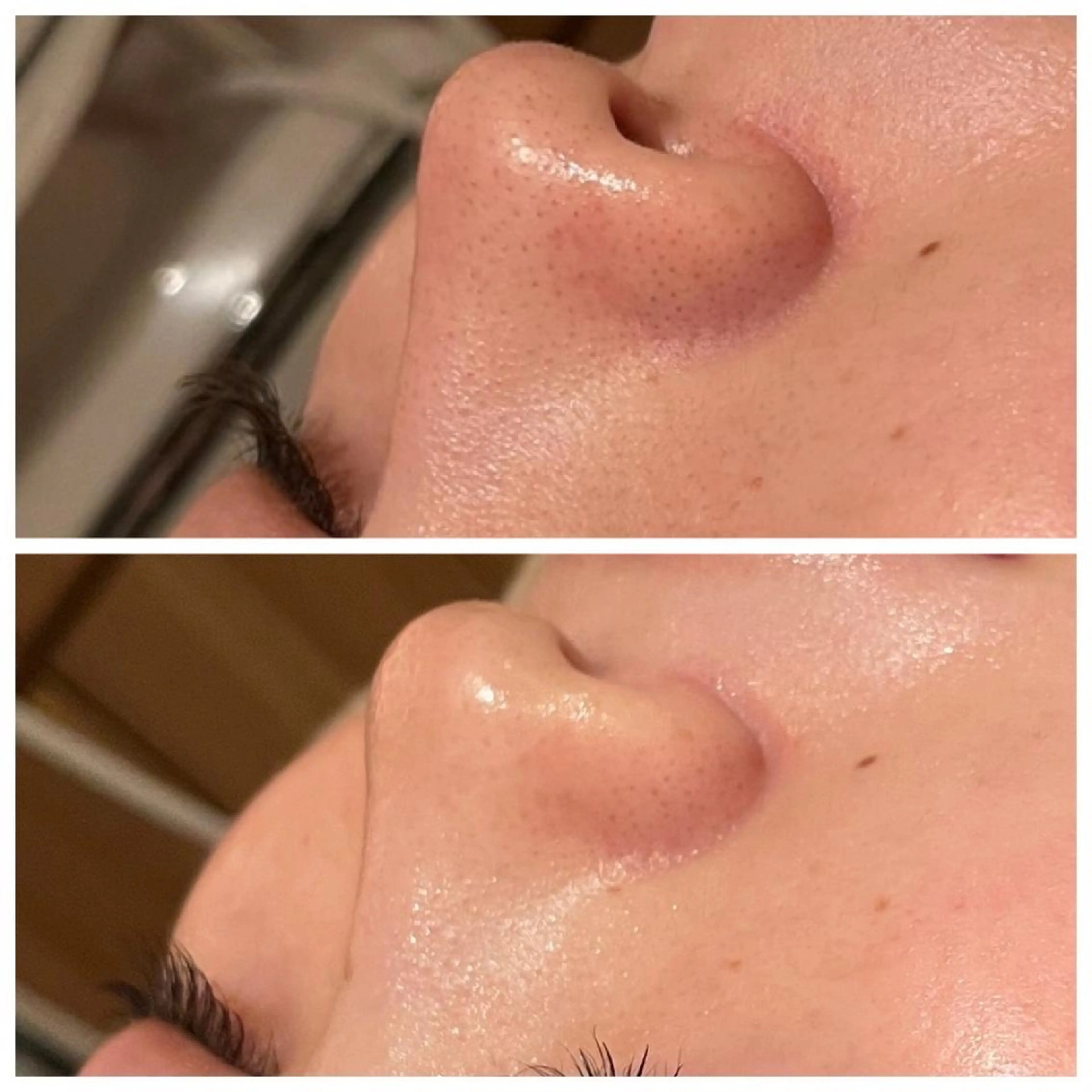 【🤍徹底美白ケア🤍】毛穴洗浄ケア＋超高保湿美白パック🔥の写真