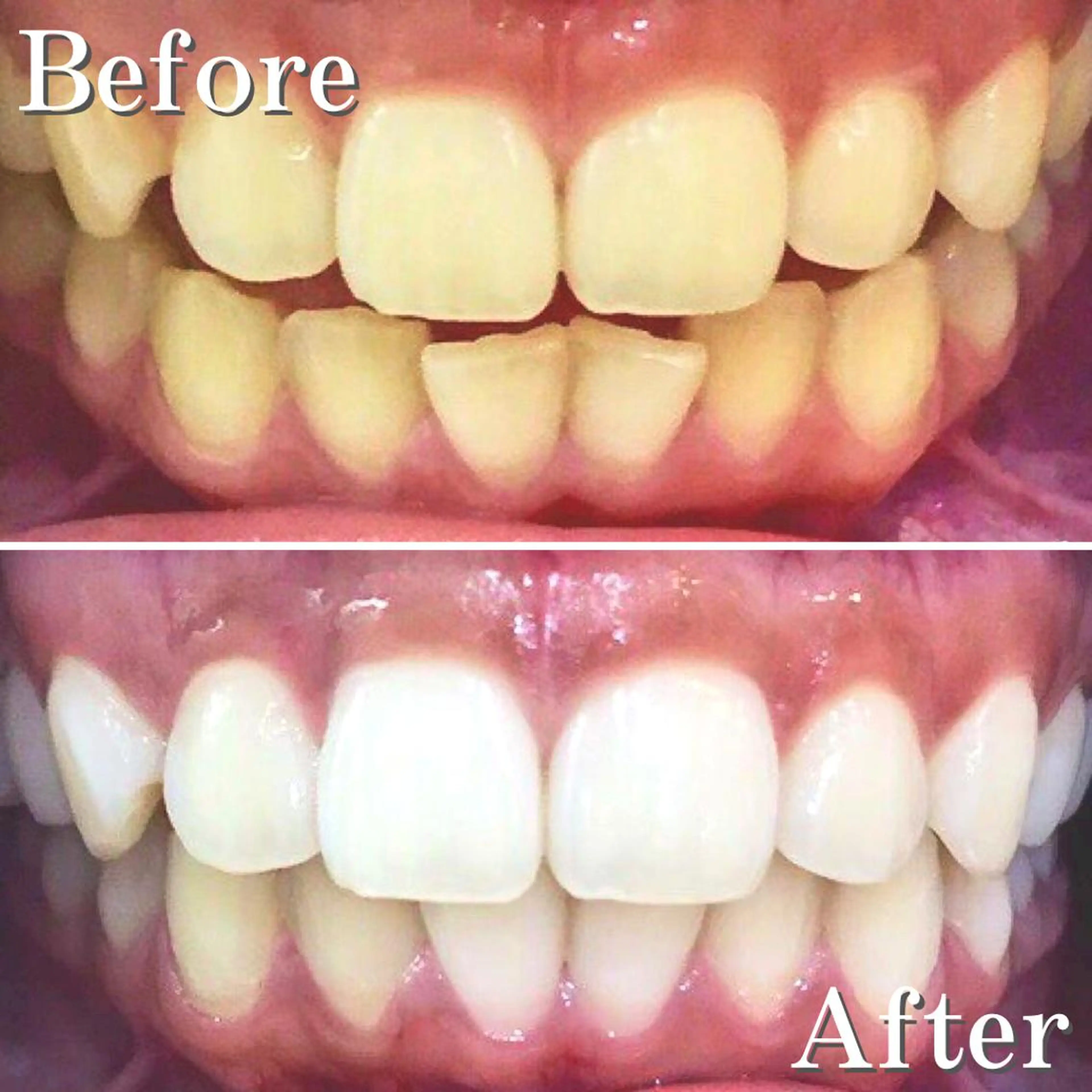 カラー パーマ アイブロウ ネイル マツエク・マツパ メンズ ヘアアレンジ 結婚式・ブライダル メンズアイブロウ 結婚式・ブライダル メンズネイル ブライダルネイル エステ リラク LBSホワイトニング 銀座店💎公式のその他イメージ