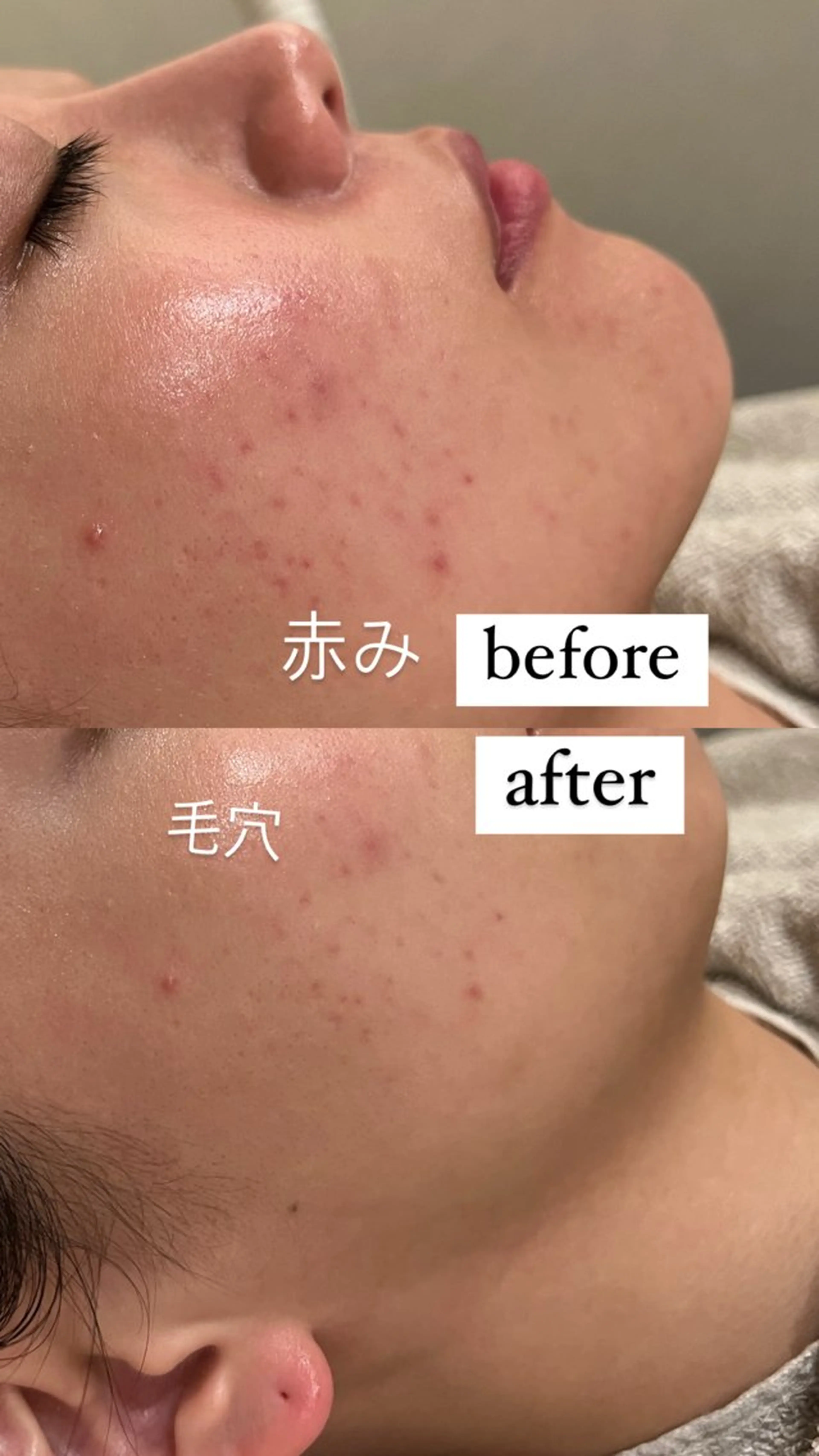 エステ リラク 【vidyto】ヴィディトゥ所属・肌管理サロン vidyto　MOEのエステ・リラクイメージ