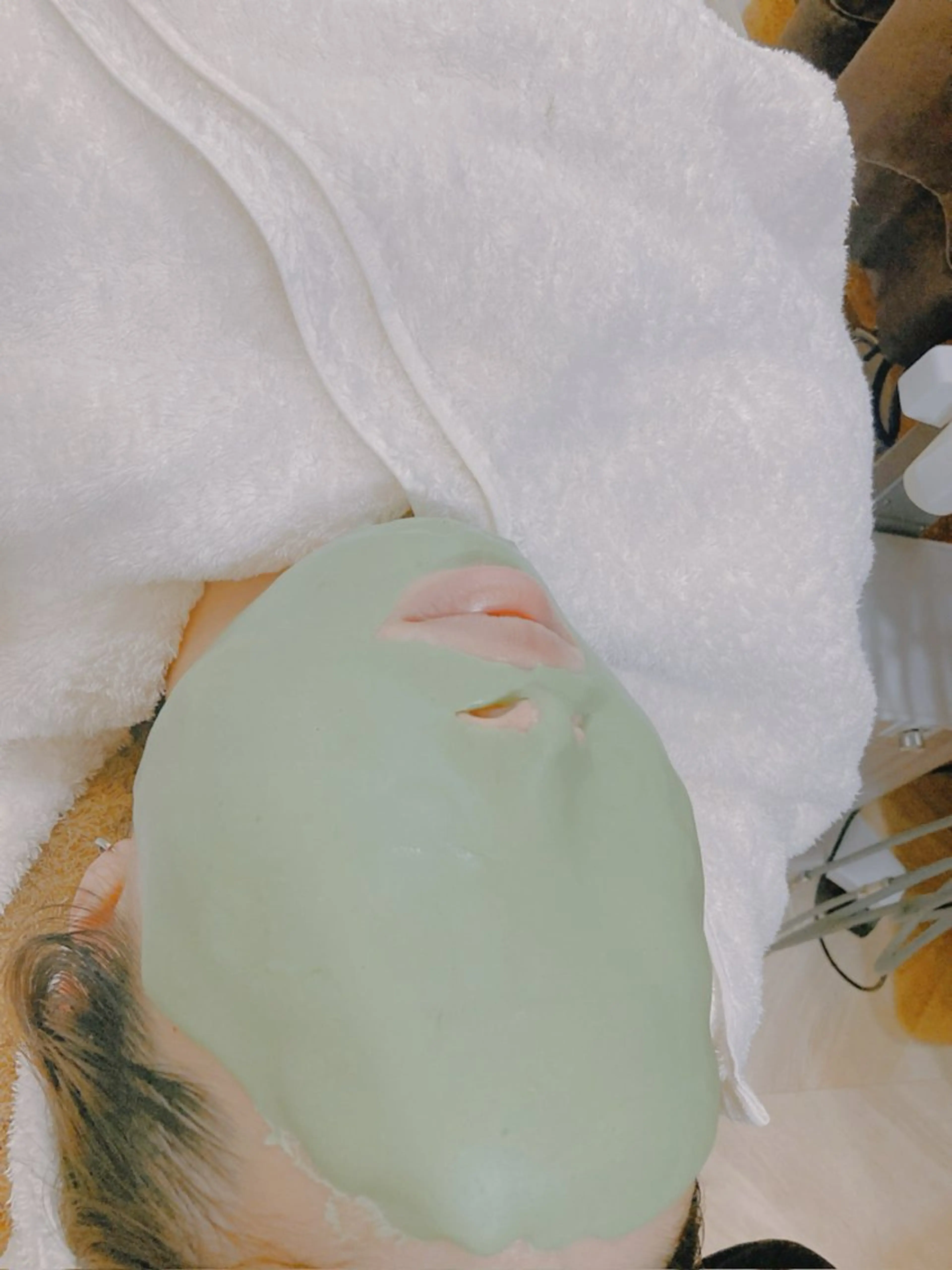 初回お試しエステ＋ビューネケアパック（お悩み→マスク荒れ・肌荒れ・ニキビ）イルネージュ使用の写真