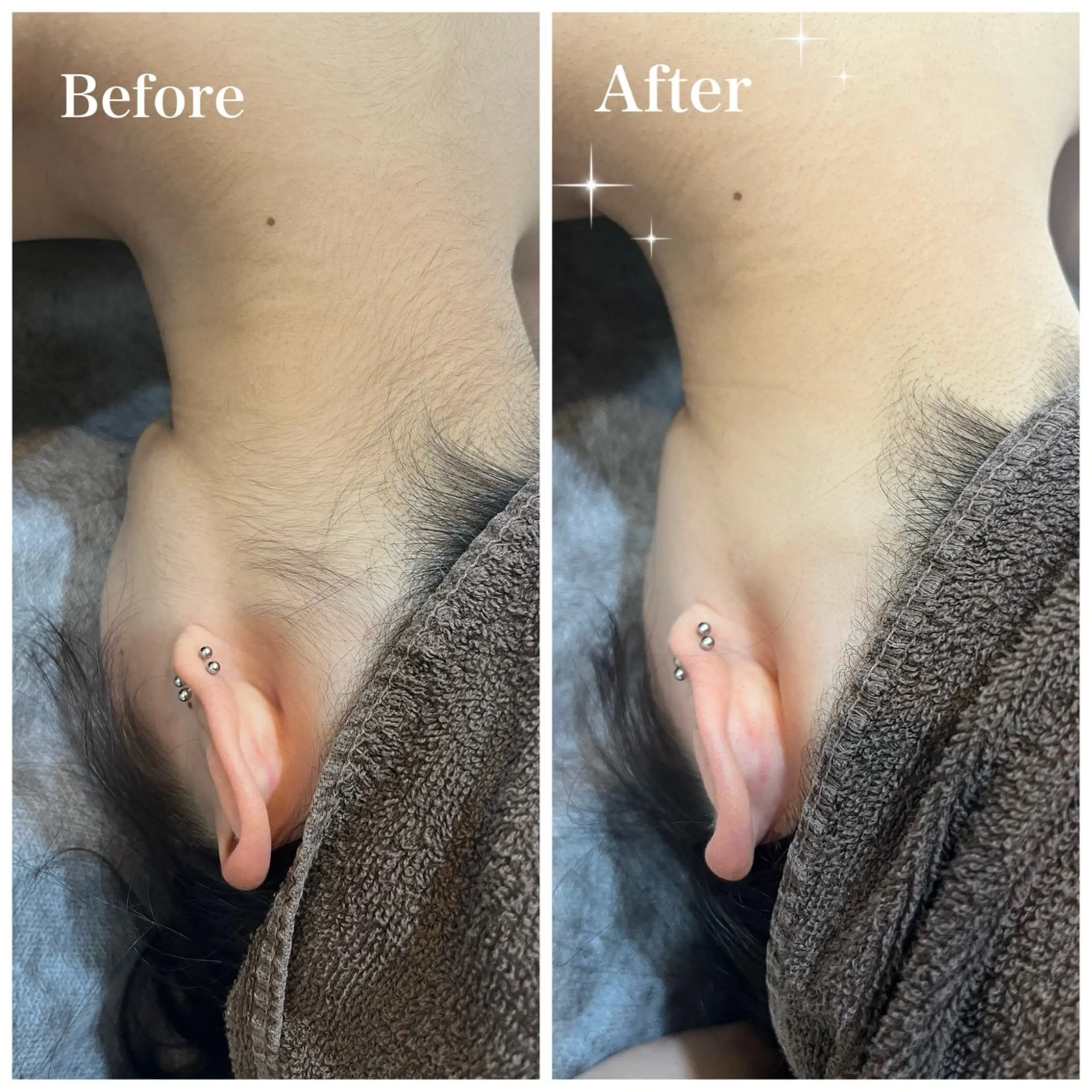 脱毛 脱毛サロン fam.豊澤柚良のエステ・リラクイメージ