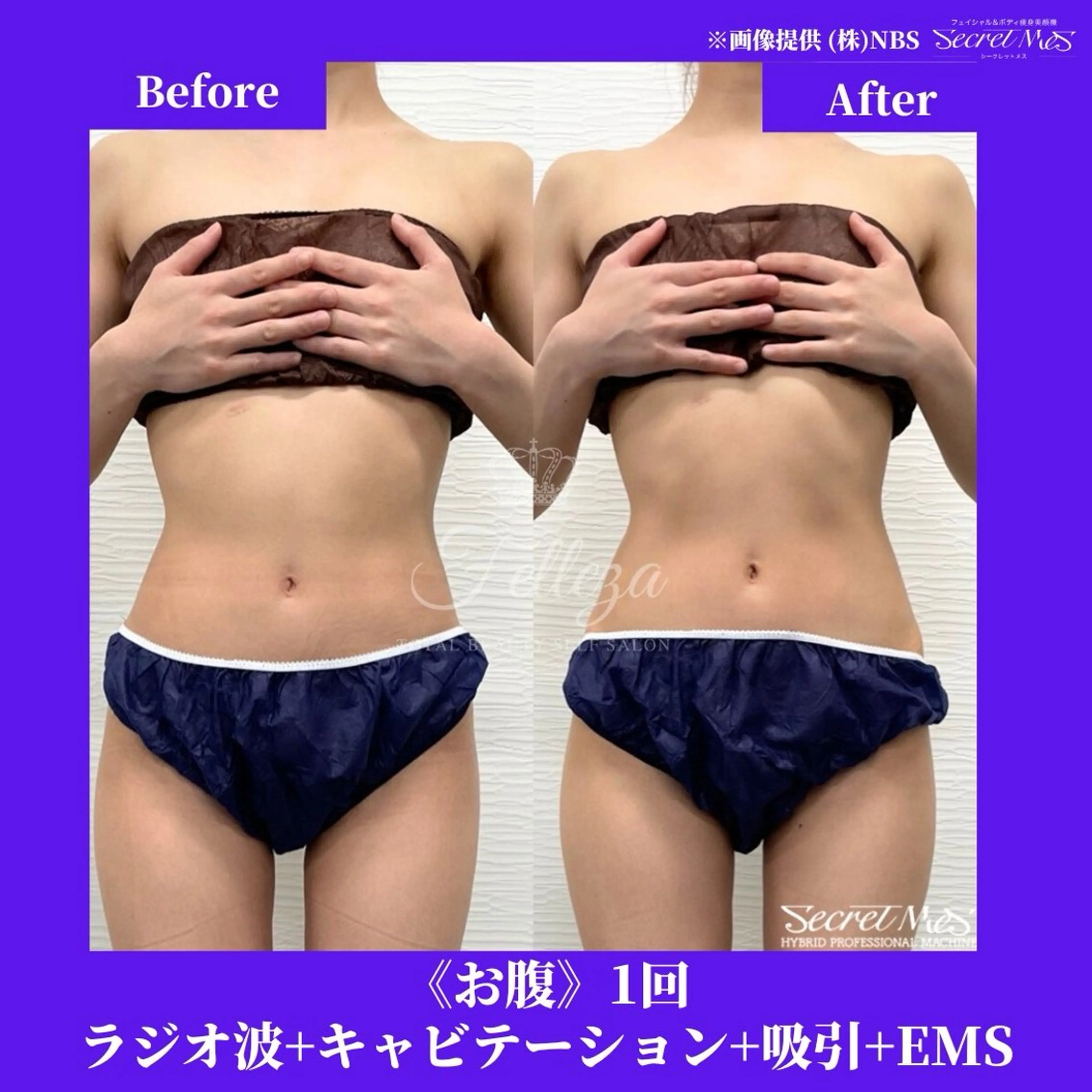 メンズ 有人型セルフサロン 脱毛／痩身／美顔のその他イメージ