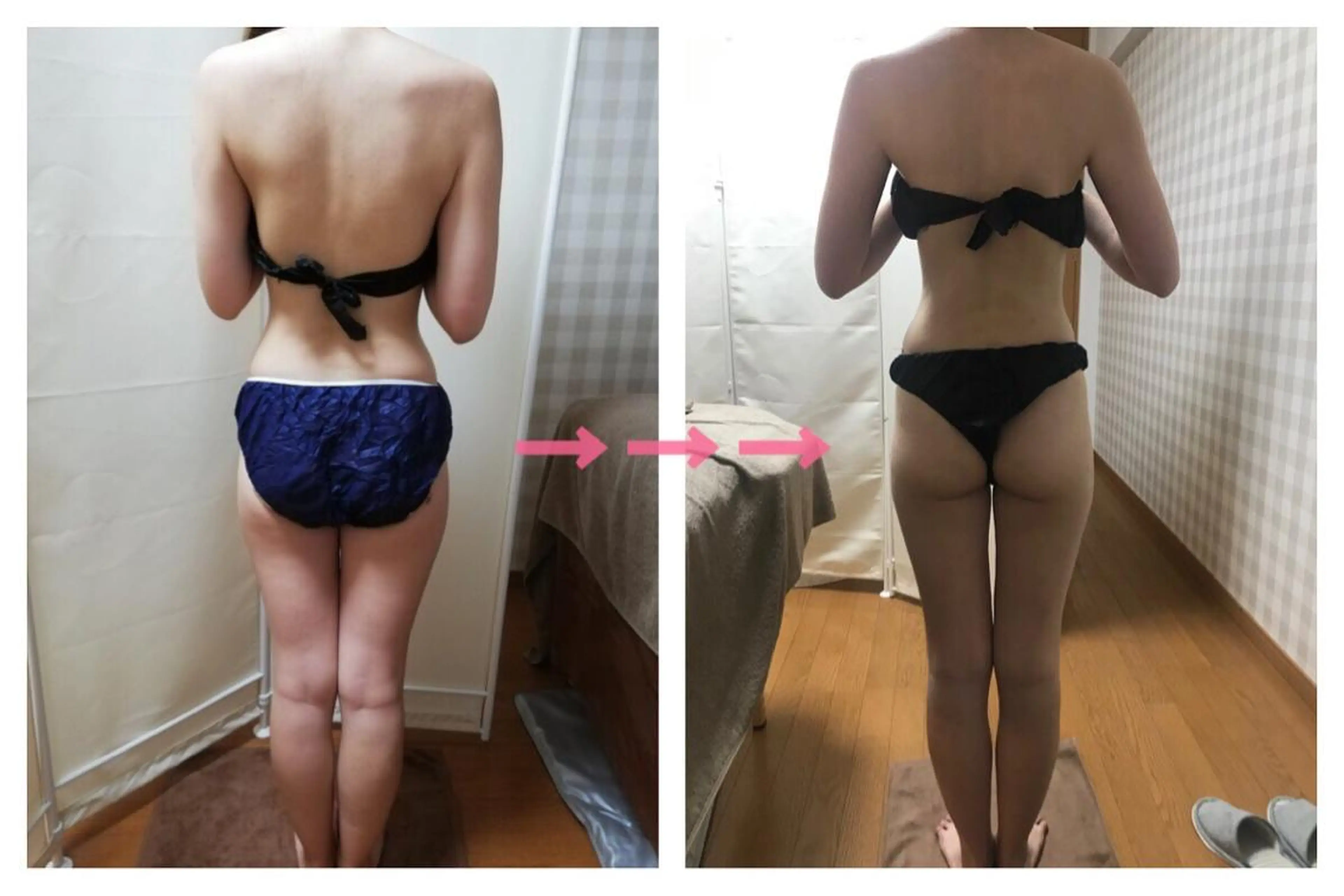 biloop所属・《痩身×疲労改善》 BILOOPのエステ・リラクイメージ