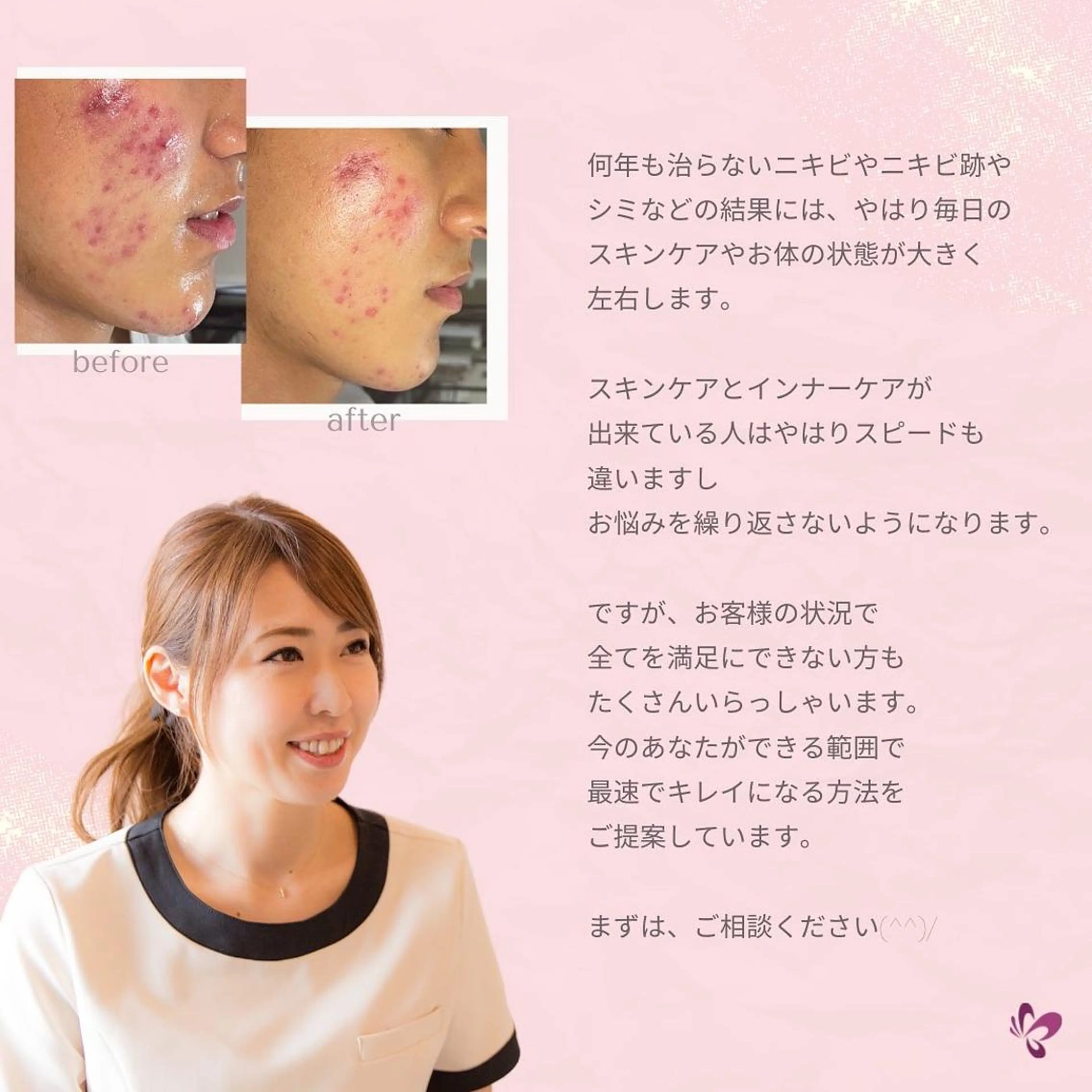 ベラージュ【美背中・ 美尻・フェイシャル】のエステ・リラクイメージ