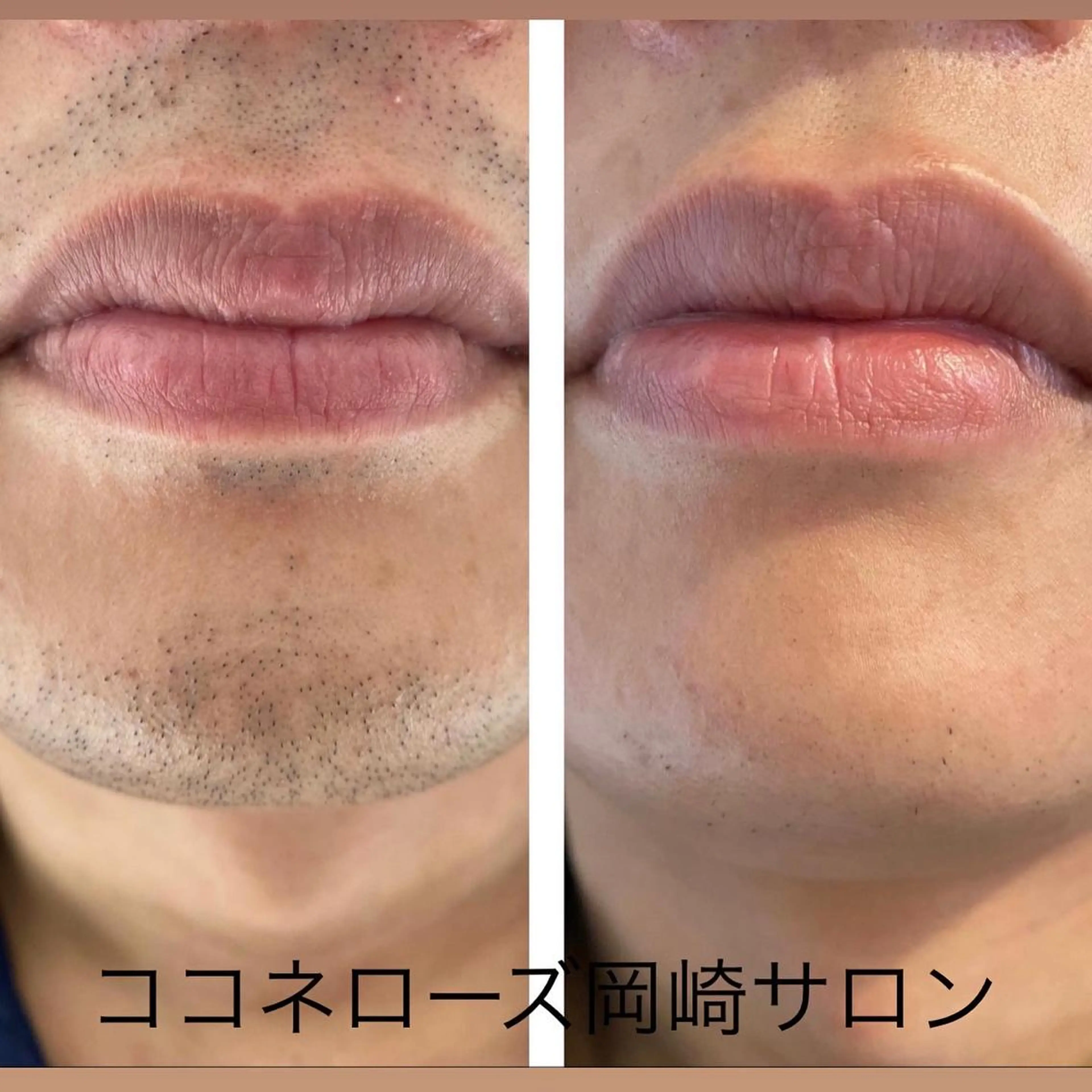 脱毛 ココネローズ 岡崎サロンのエステ・リラクイメージ