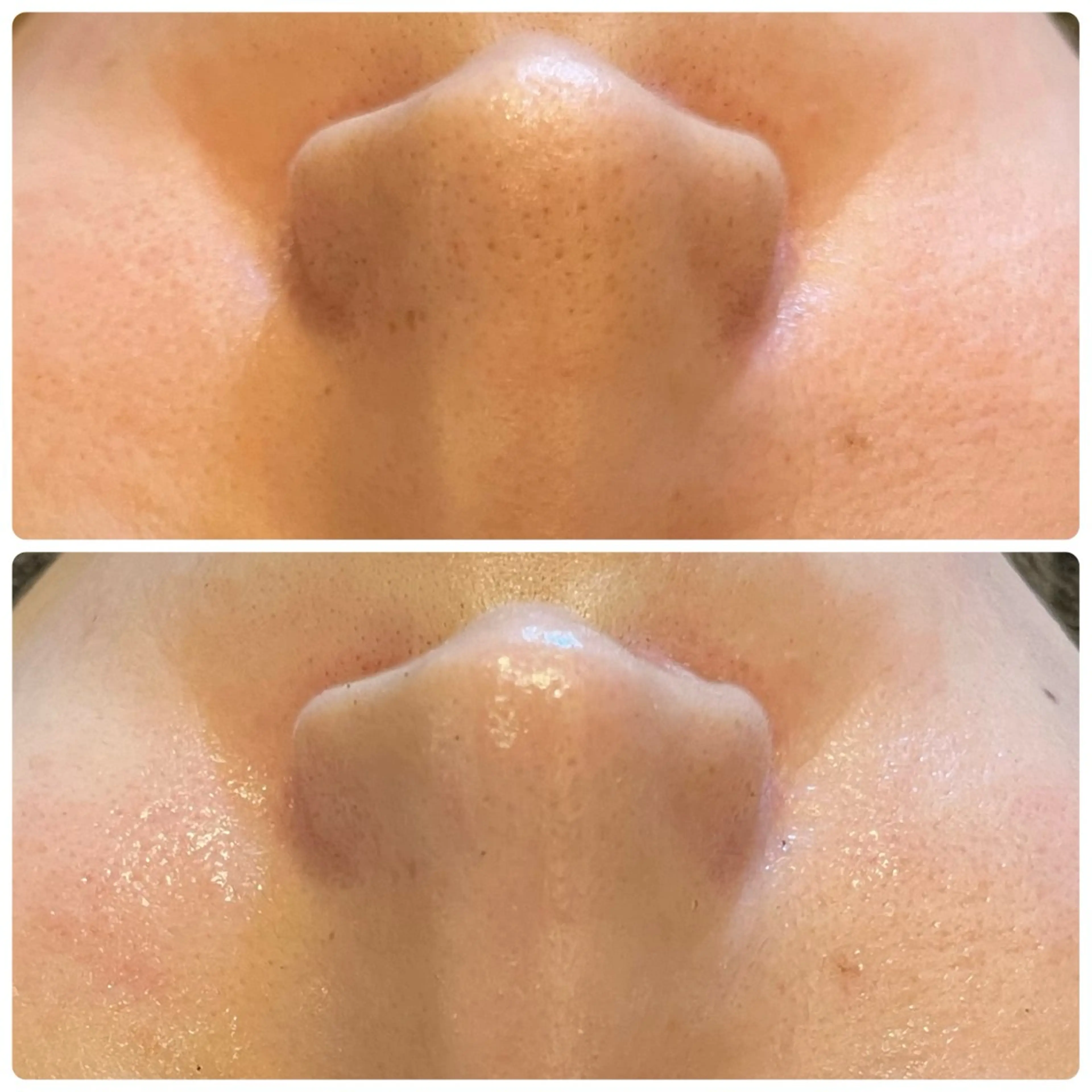 yellow.所属・yellow💛【 脱毛&フェイシャル】のエステ・リラクイメージ