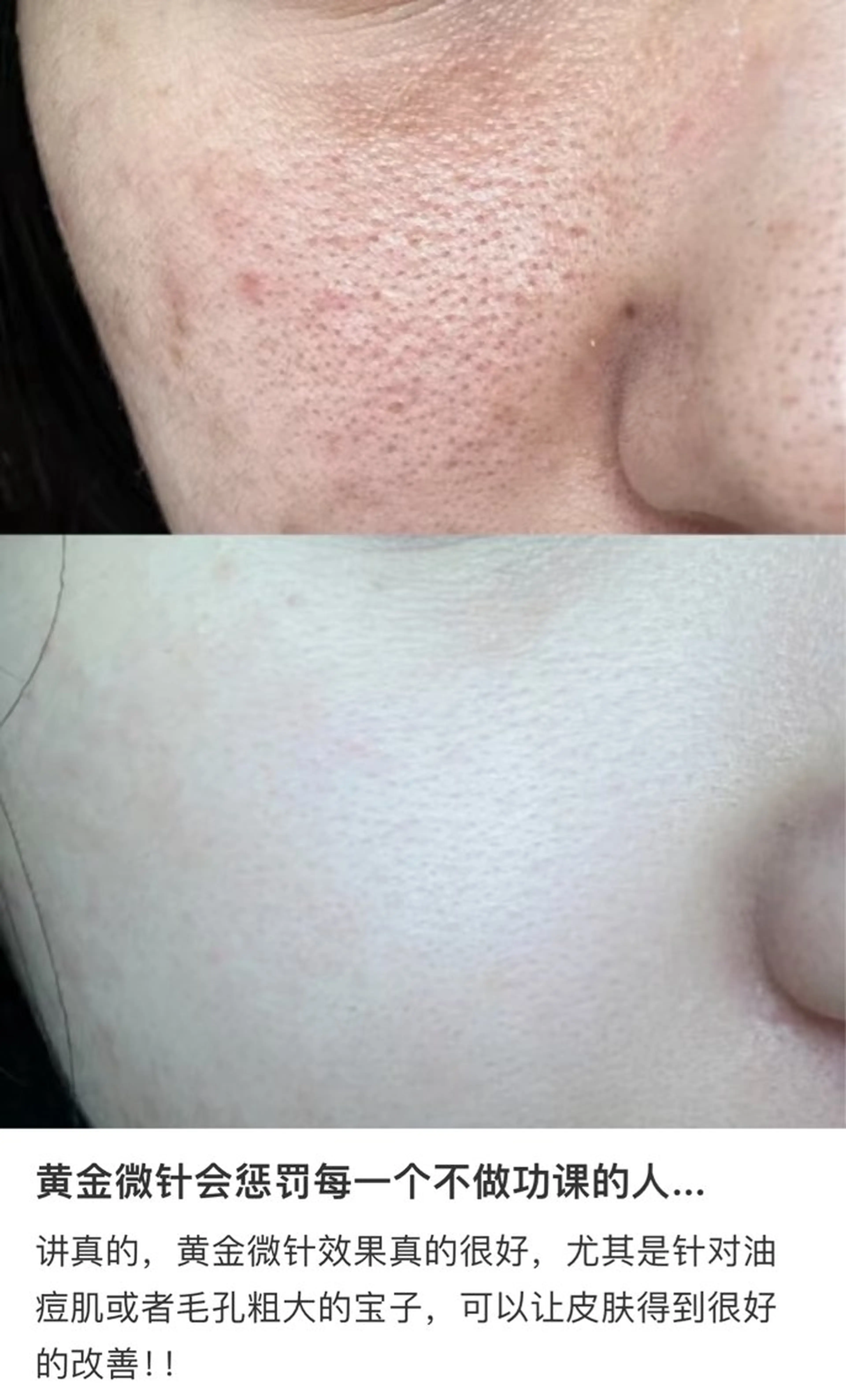 ネイル エステ aliaハイフ&水光ジェットサロン所属・aliaハーブ水光店 エステティシャン募集のエステ・リラクイメージ