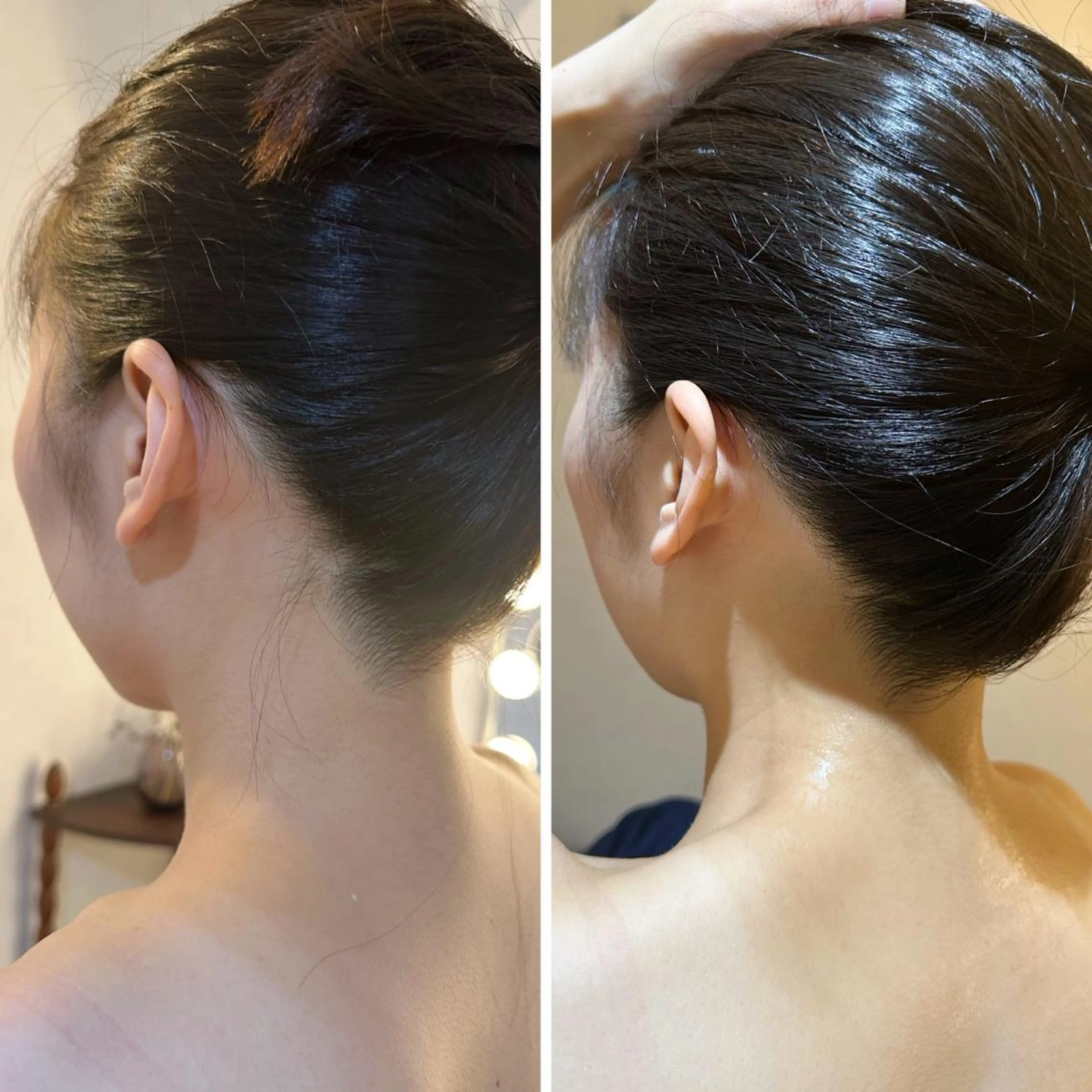 脱毛 うなじ脱毛/美肌脱毛 LABELのエステ・リラクイメージ