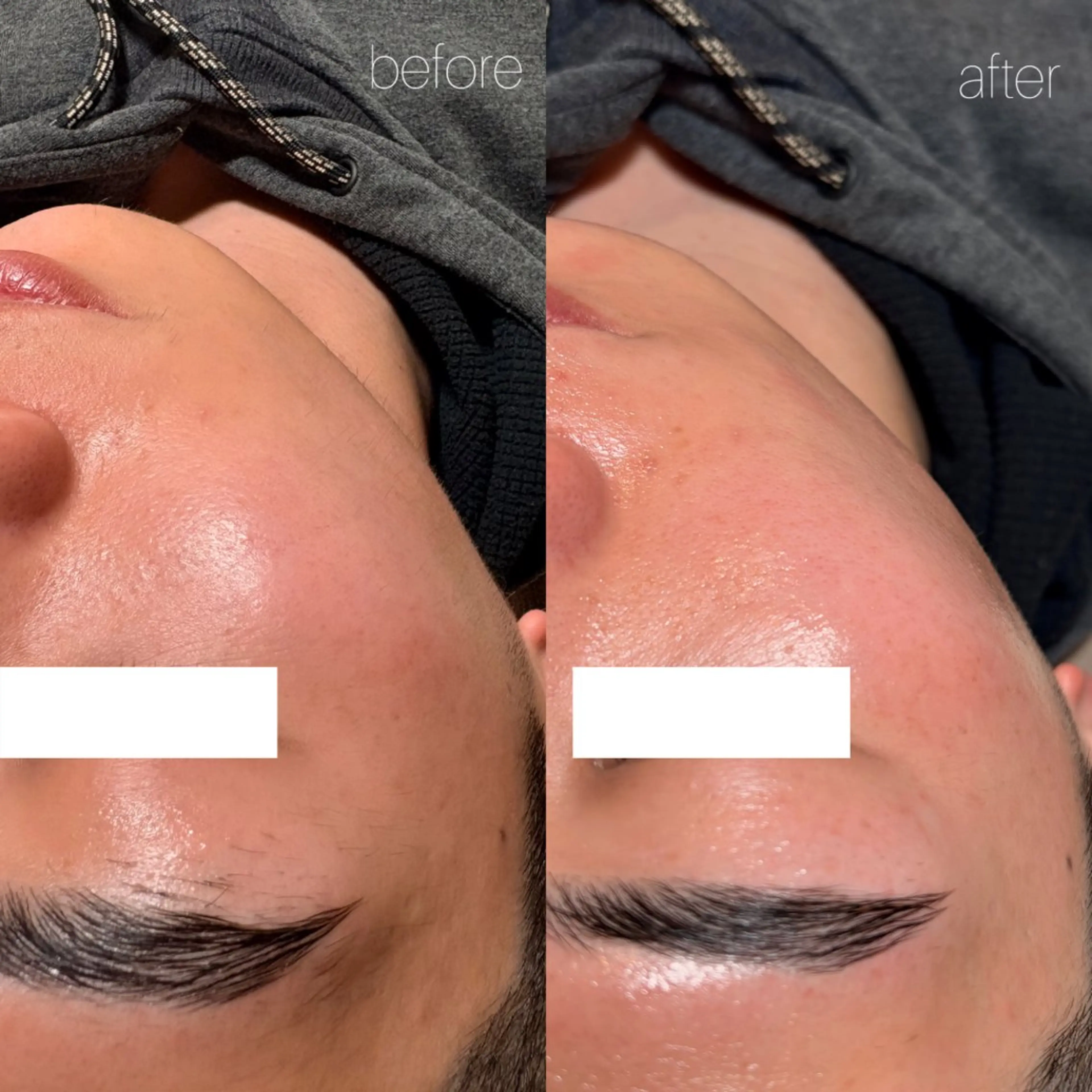 メンズ アイブロウ メンズアイブロウ 脱毛 Lassy Yuriの眉毛・アイブロウイメージ