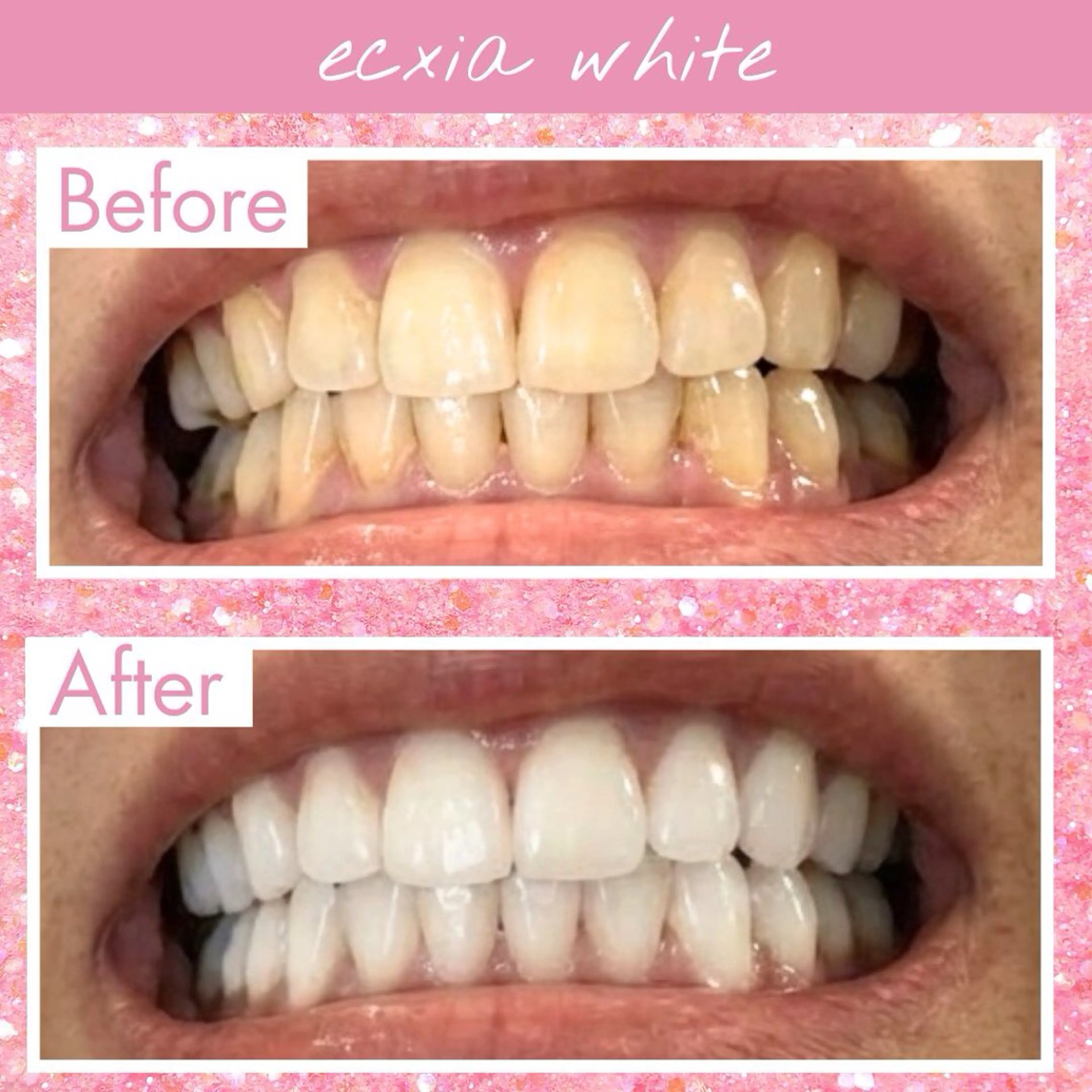 セルフホワイトニング エクシア西宮北口店所属・セルフホワイトニング エクシア西宮北口店のその他イメージ