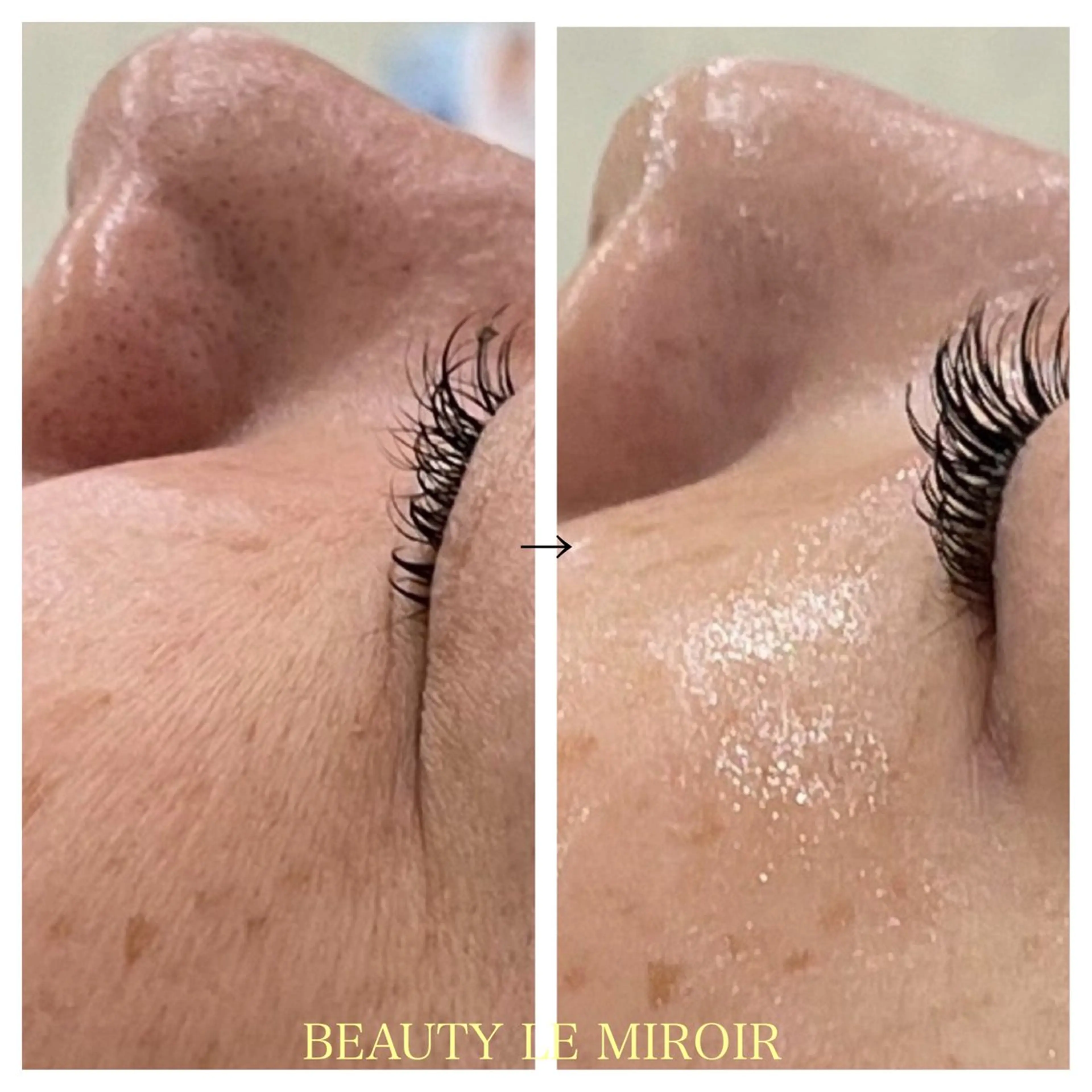 ビューティー ミロワールのエステ・リラクイメージ