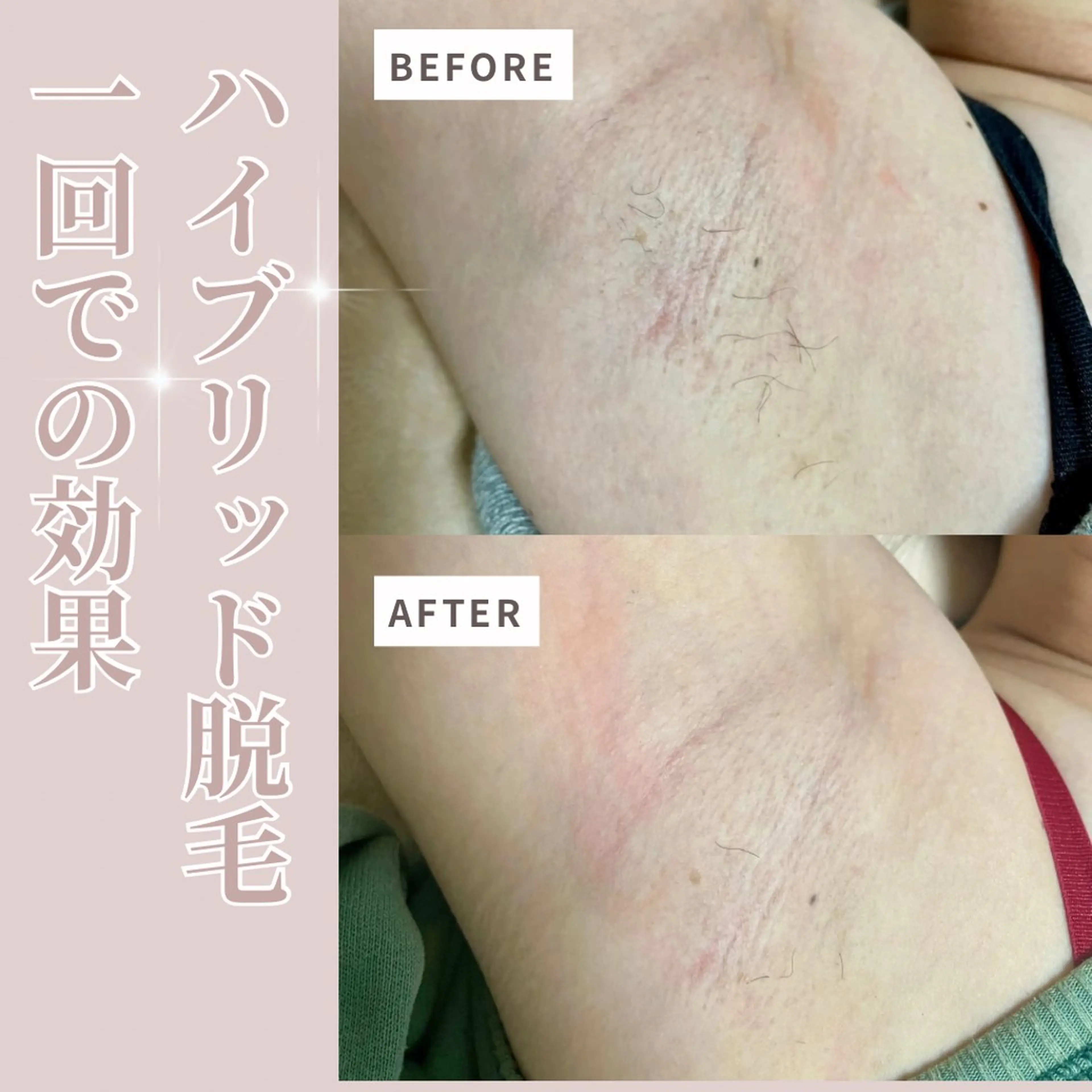 脱毛 プライベートサロン Belle（ベル）のエステ・リラクイメージ