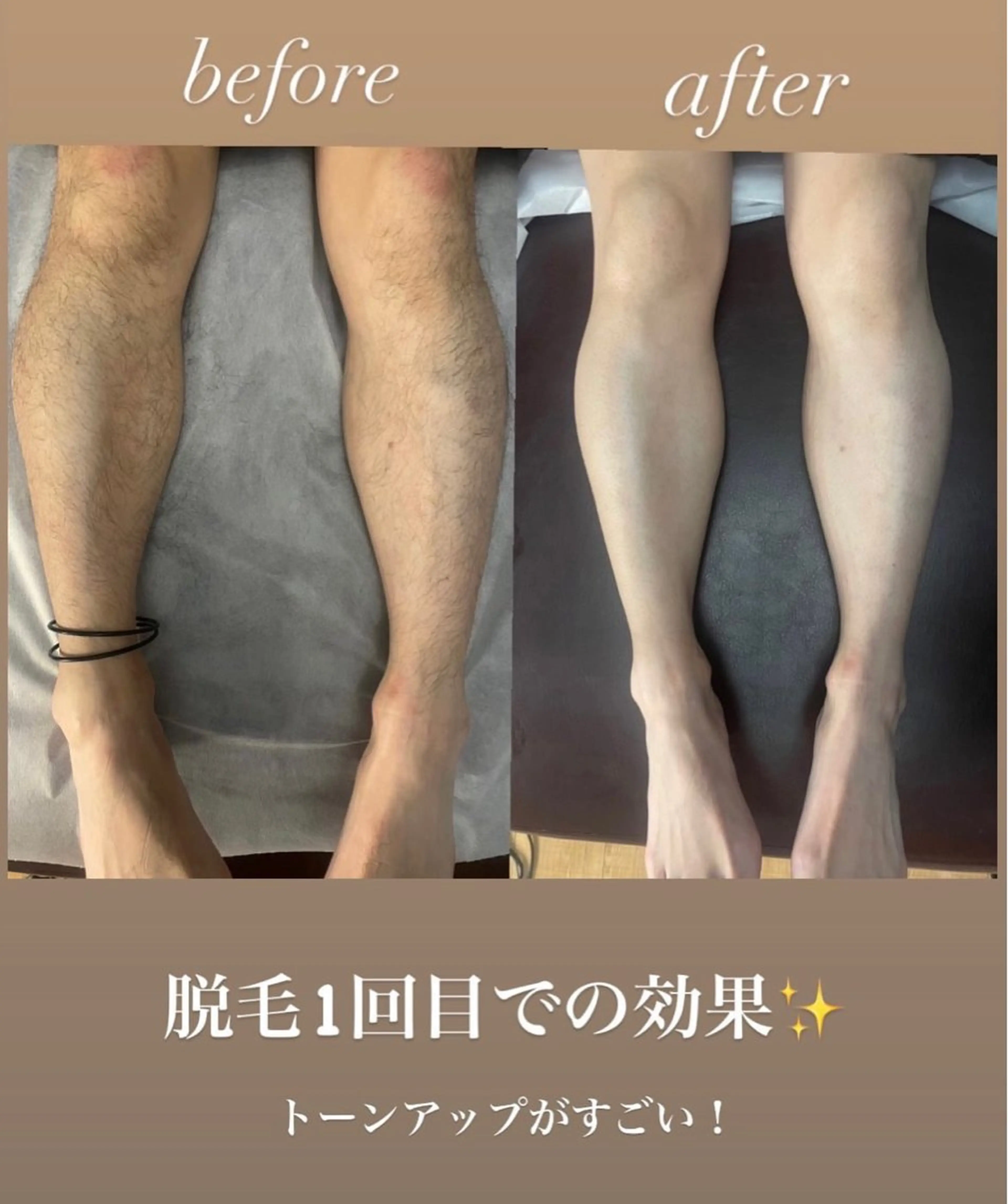 メンズ キッズ 脱毛🌈Beauty Salon新宿店のエステ・リラクイメージ