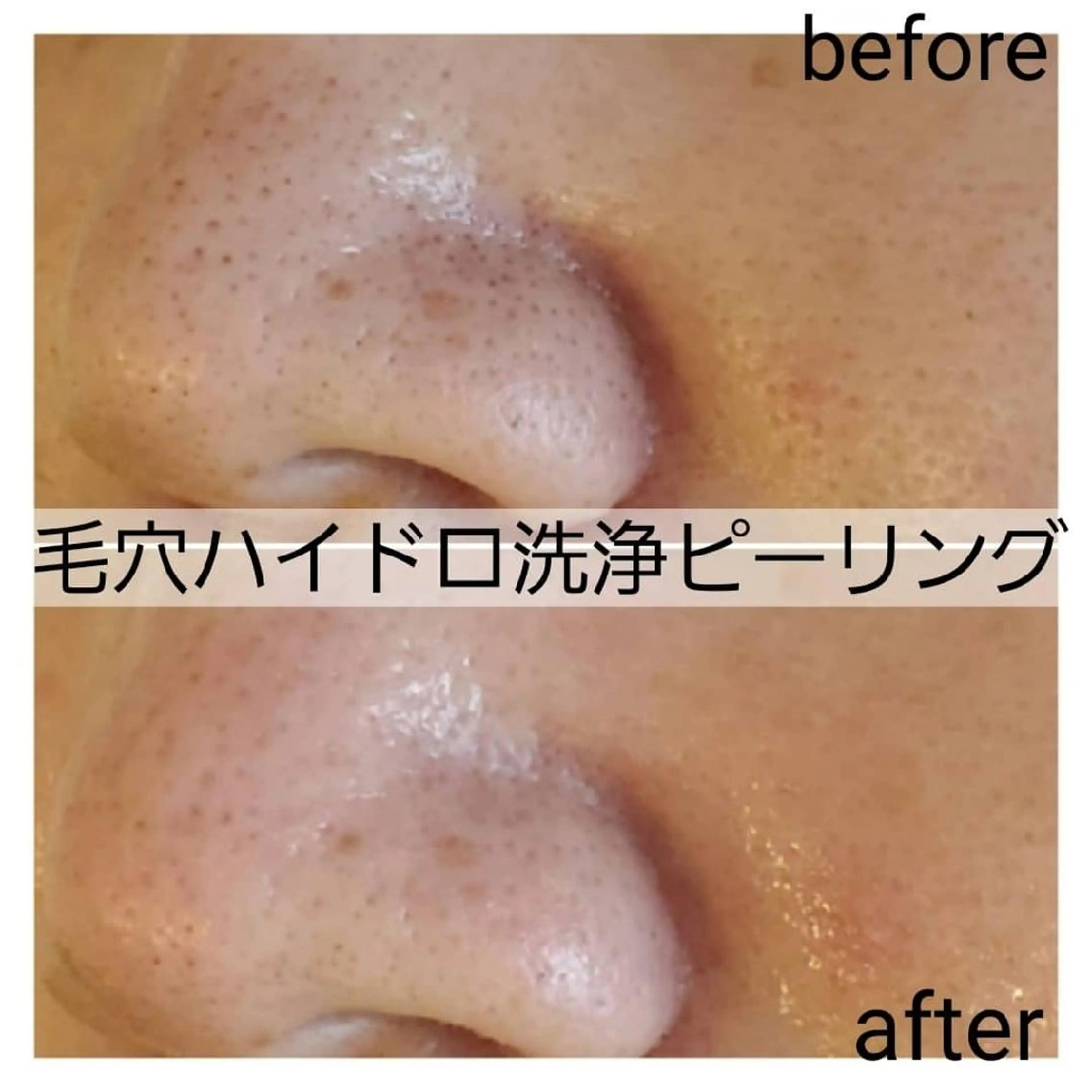 メンズ 小顔・美肌ケア専門 Diva北浜のエステ・リラクイメージ