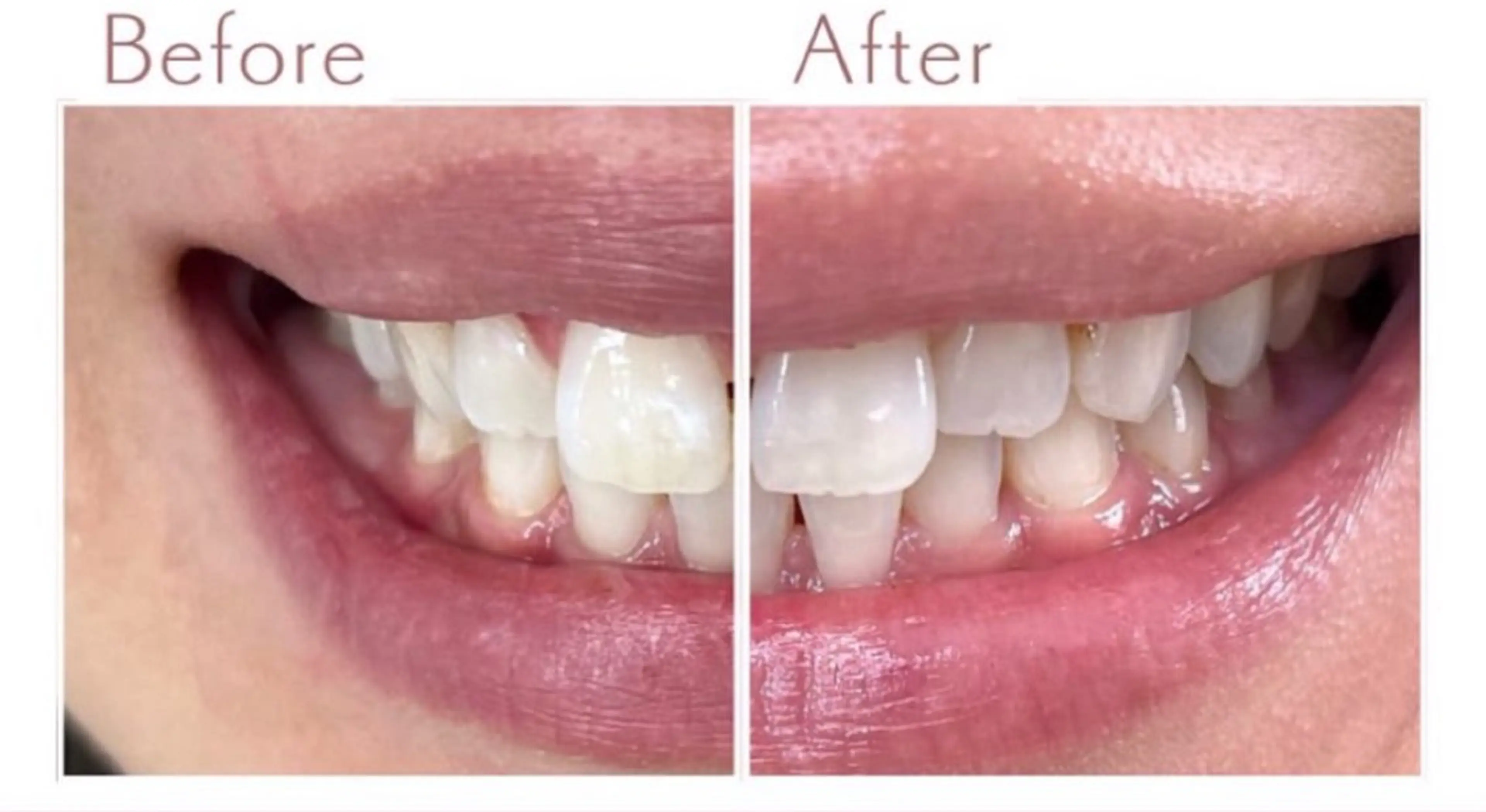 セルフホワイトニング　エクシア盛岡中央通店所属・セルフホワイトニング エクシア盛岡あっくんのエステ・リラクイメージ