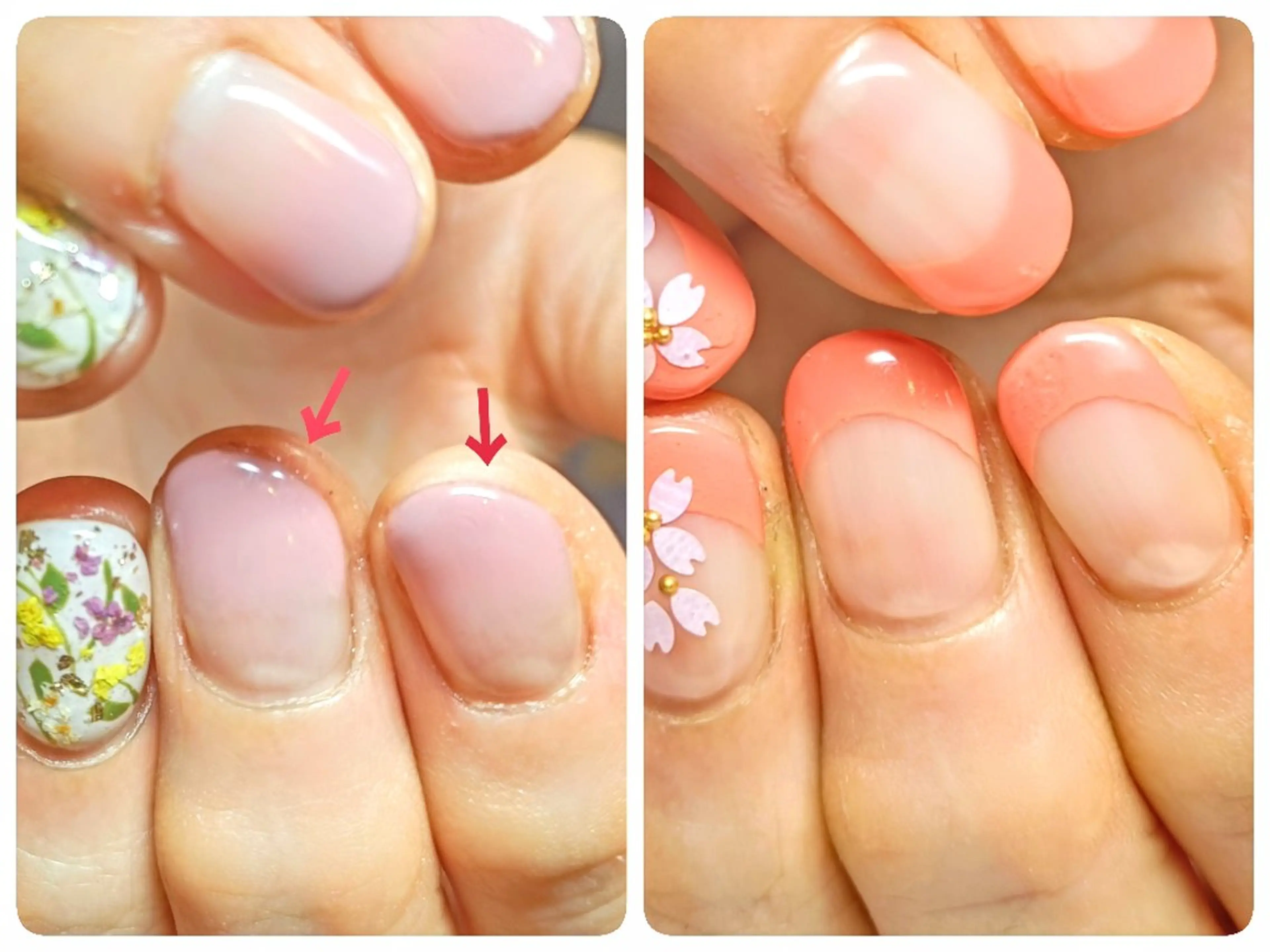 ネイル 長さ出し ジェルネイル ハンドネイル ハンドケア 深爪矯正/爪育成ケア manie nailのネイルデザイン