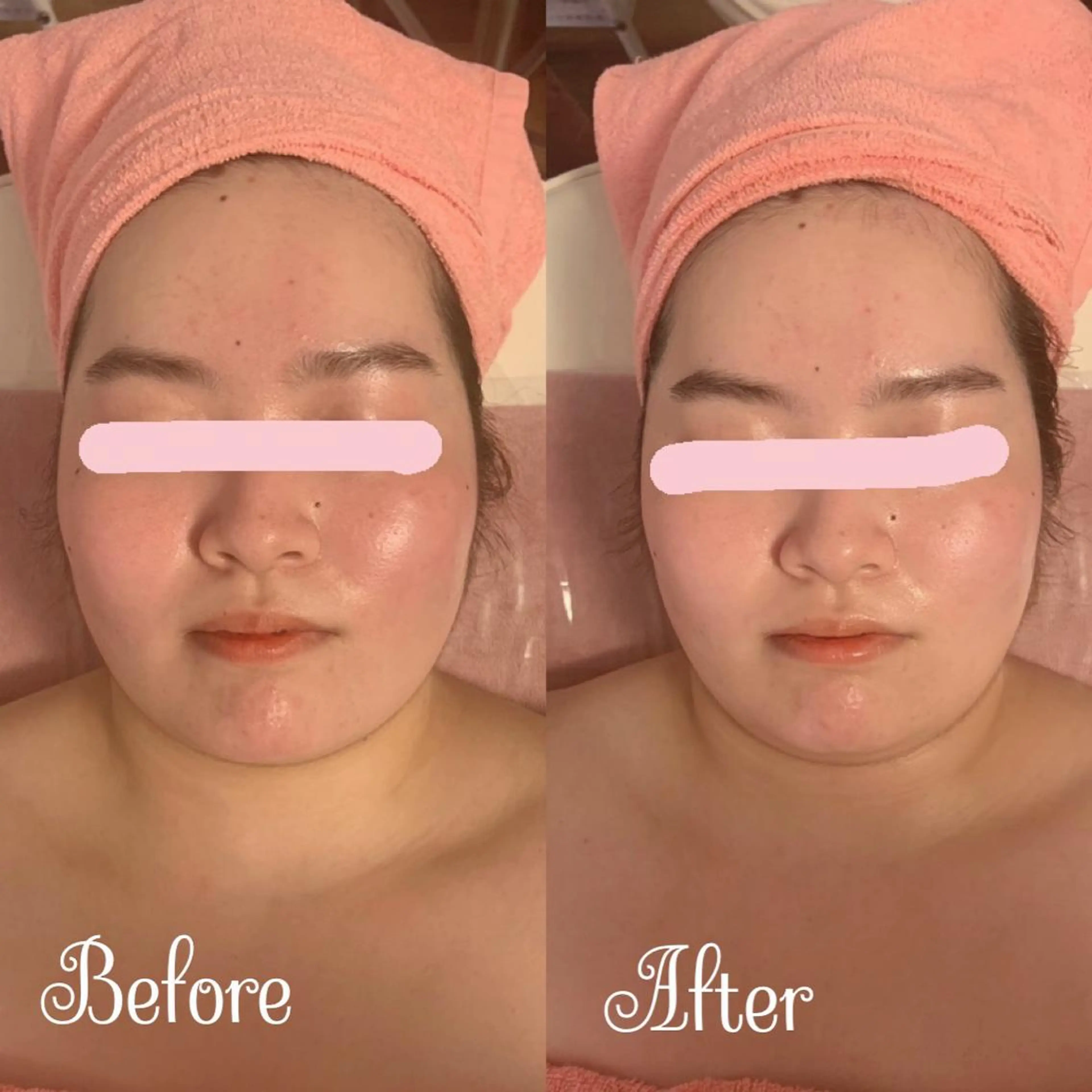 透明感の肌Lino malieのエステ・リラクイメージ