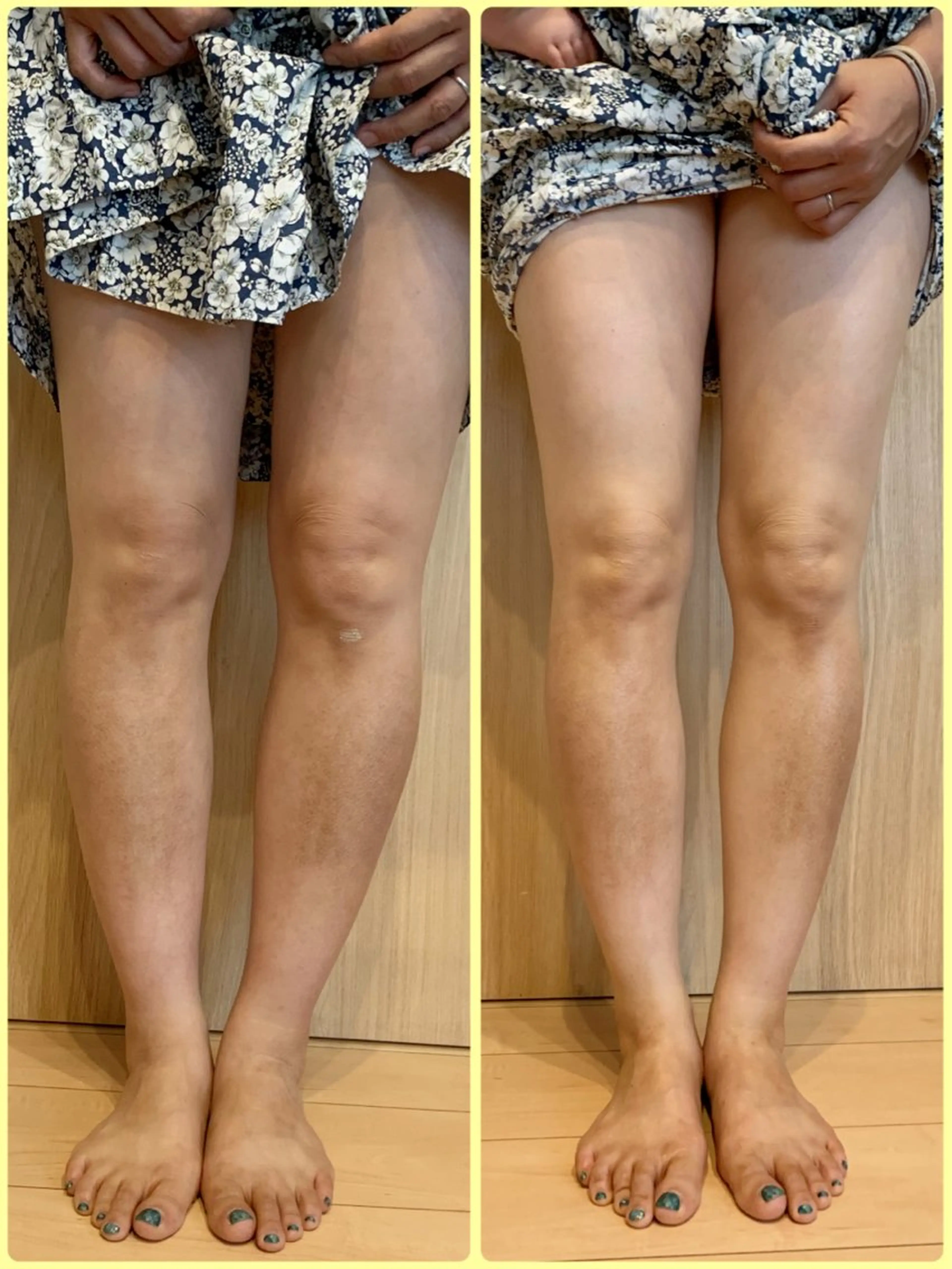 エステ at home エステLumiereのエステ・リラクイメージ