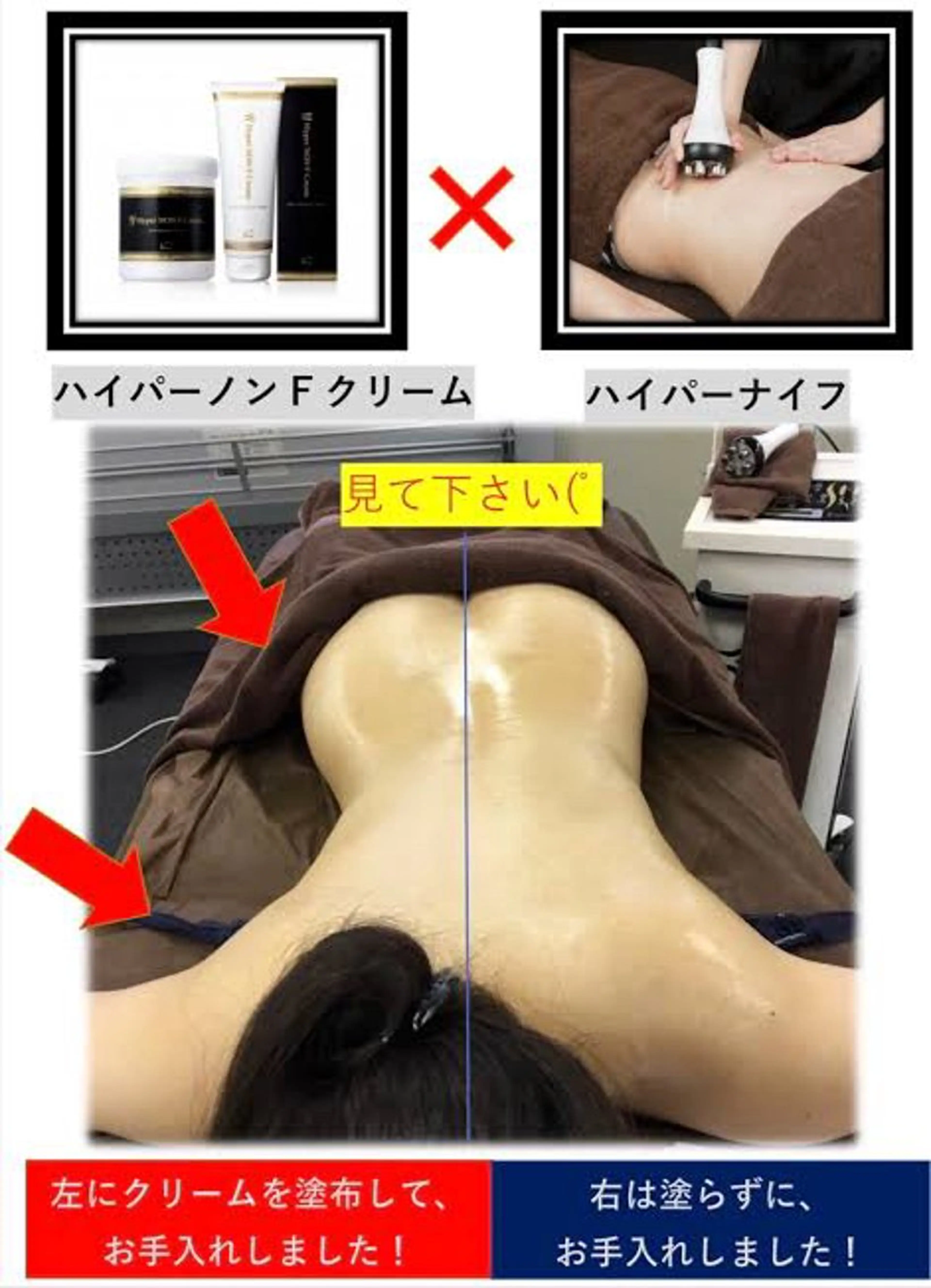 【顔＆全身】ハイパーナイフ7＋シェイプ＋アロマ　ヒートマットと頭マッサージ含め　190分の写真