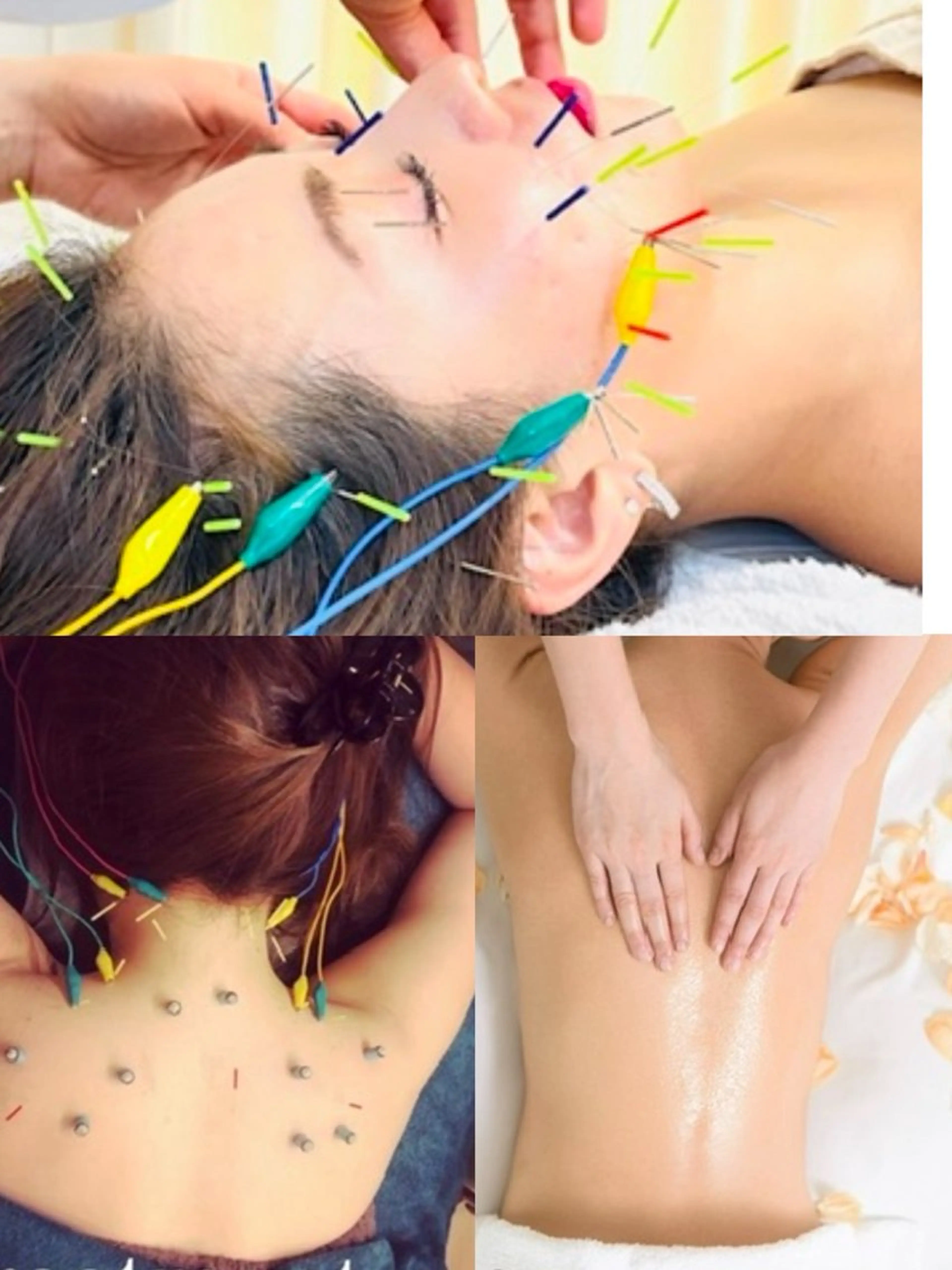 疲れすぎた方【お身体施術人気No3】美容鍼+全身鍼🪶お顔も体もスッキリ爽快✴︎120分の写真