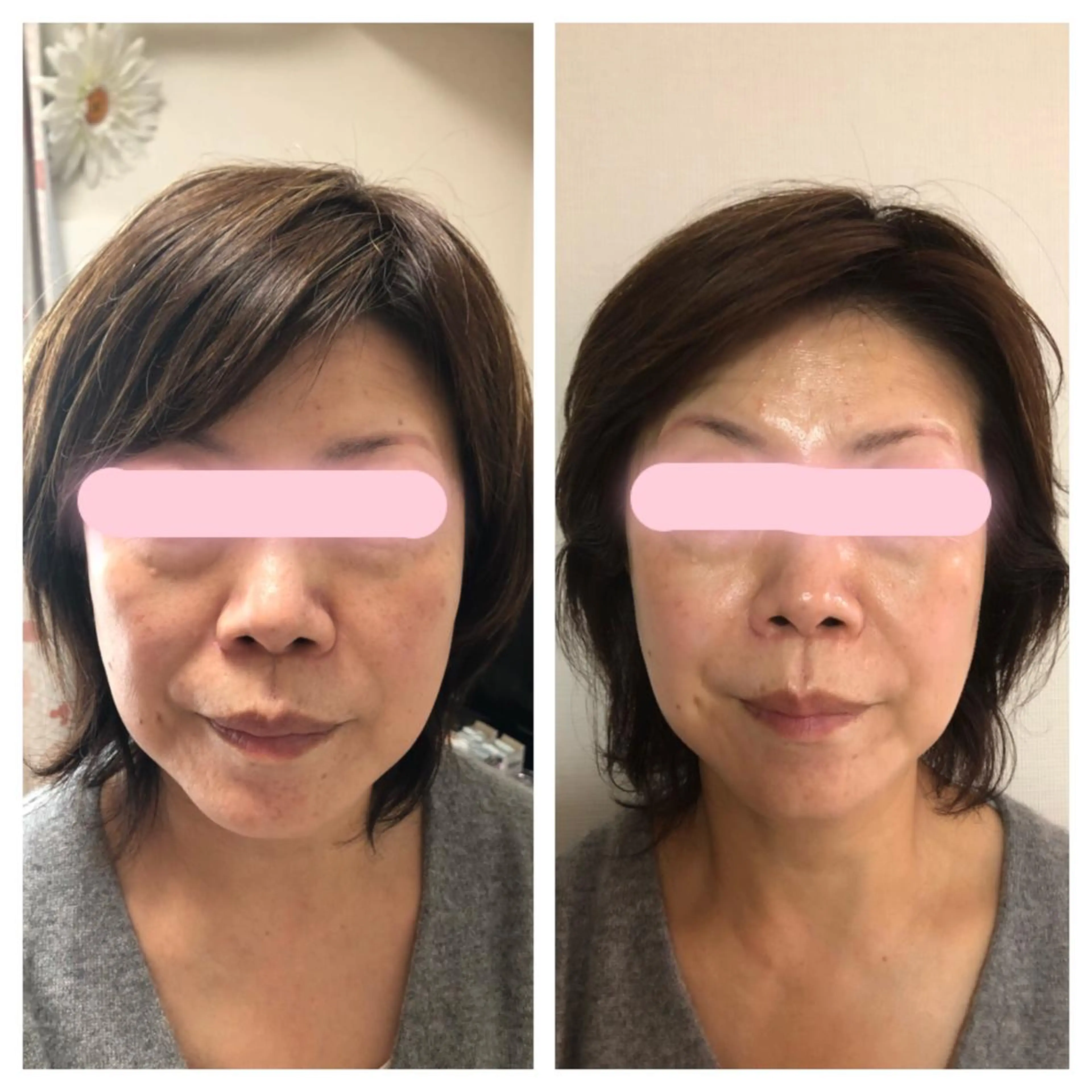 HARIKA鍼灸所属・HARIKA 鍼灸のその他イメージ