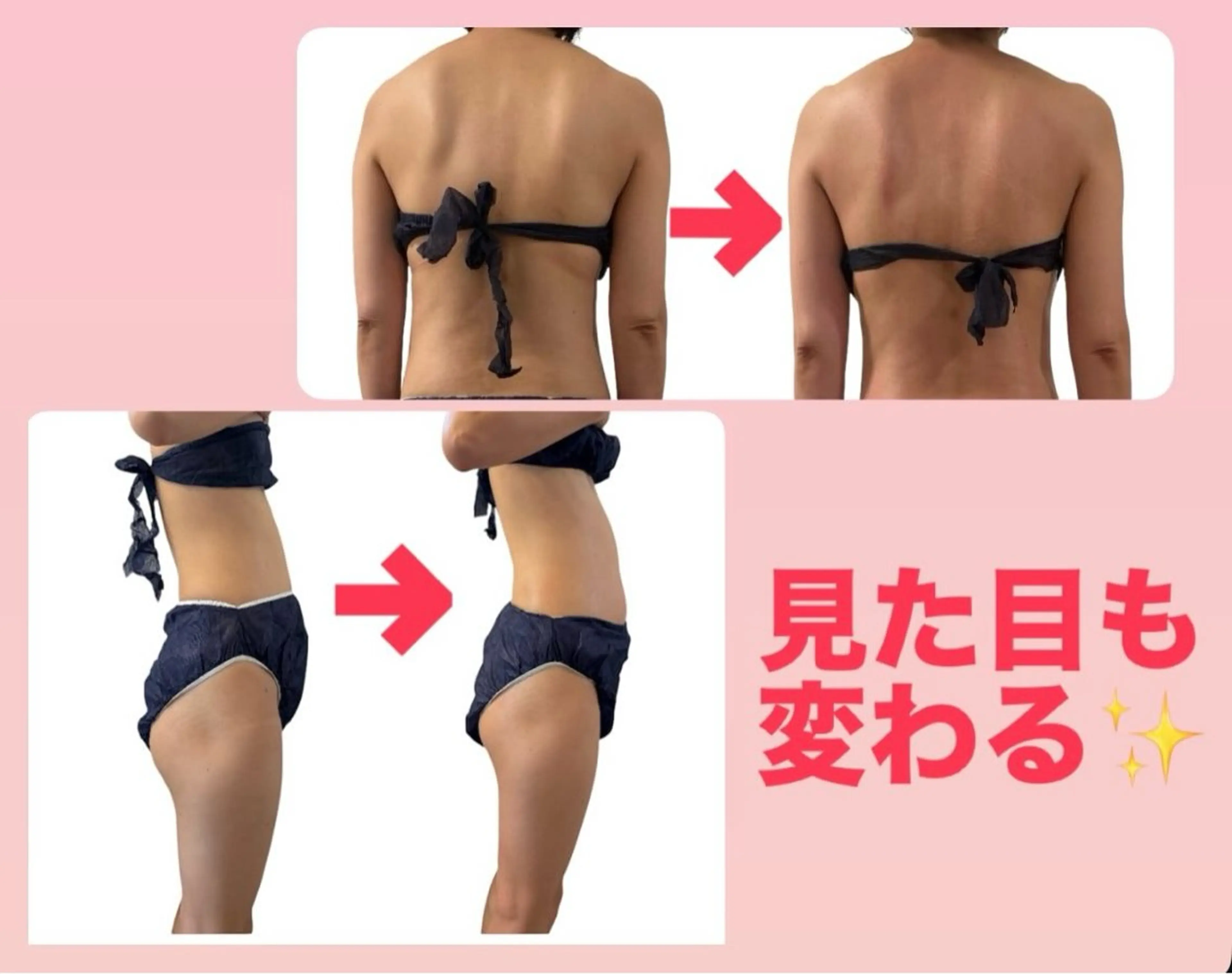 冷え太り改善コース　✨💎120分💎✨の写真