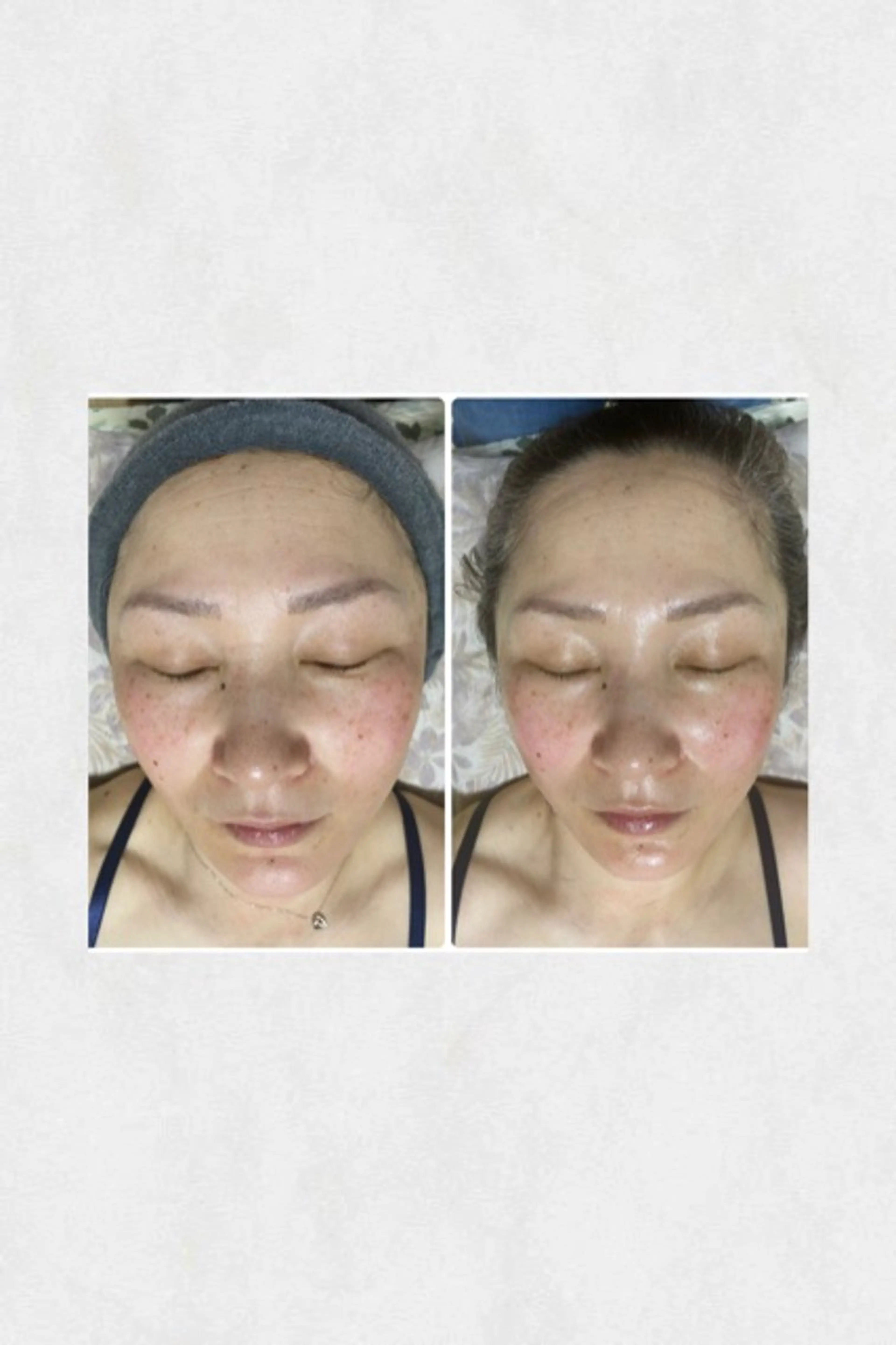 エステ リラク 松山 碧のエステ・リラクイメージ