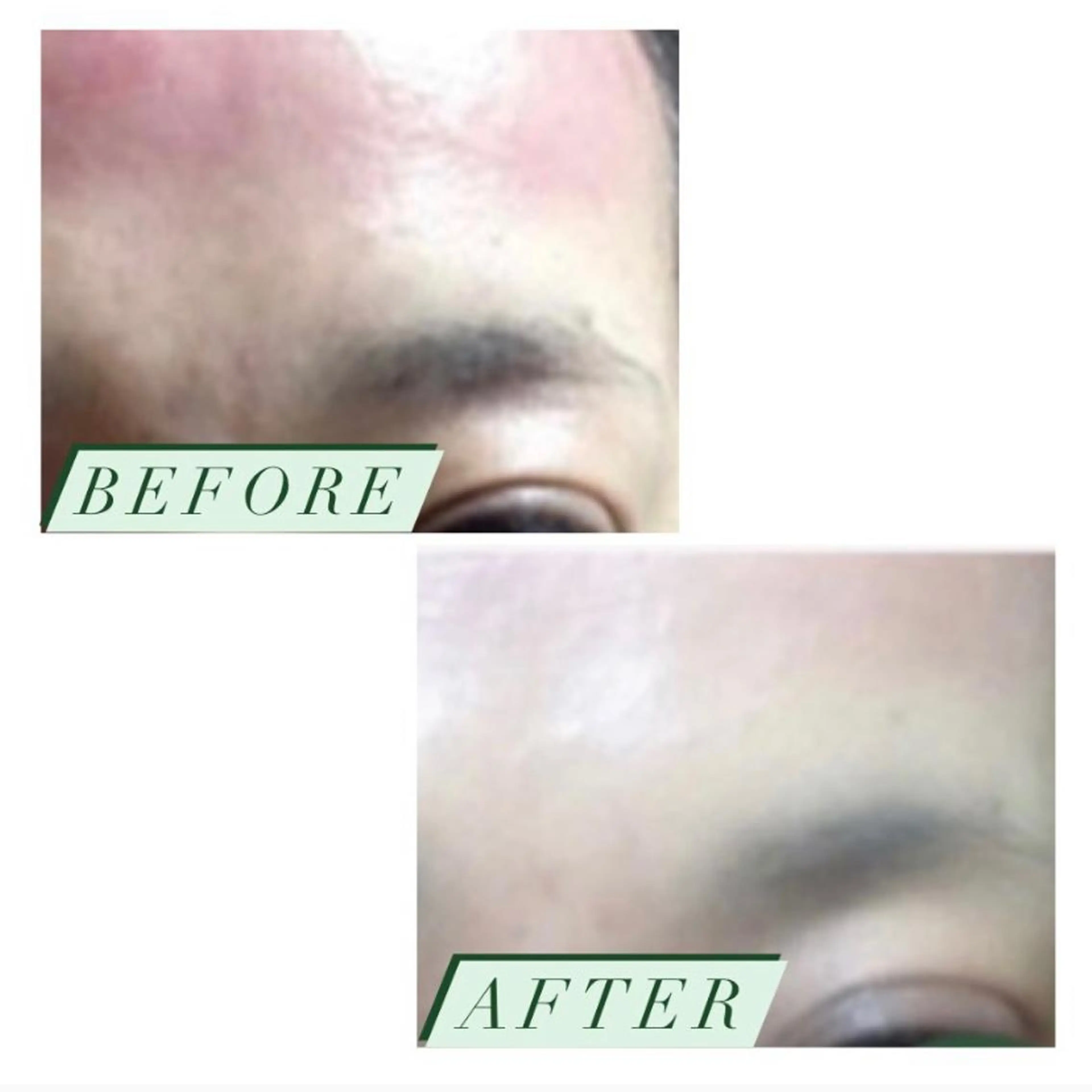 ハーブピーリング・毛穴ケア専門サロンSalon de LENA所属・ハーブピーリング 専門店/名古屋駅前店のその他イメージ